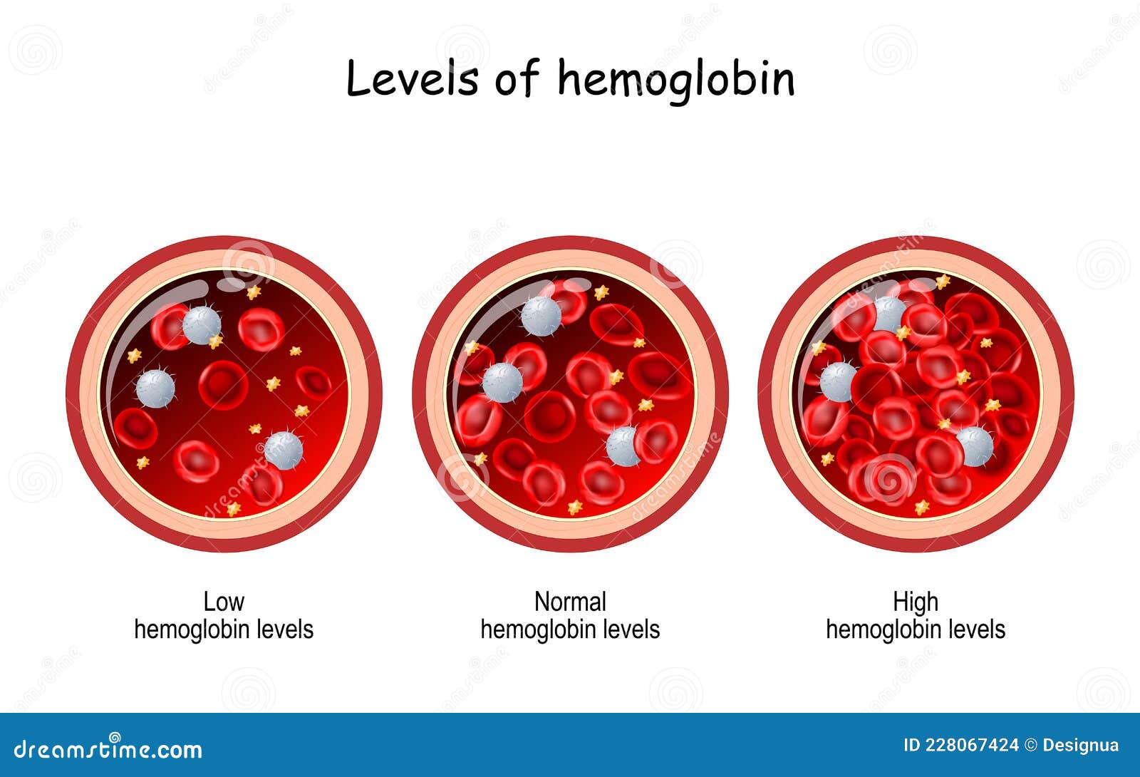 Nivel de hemoglobina