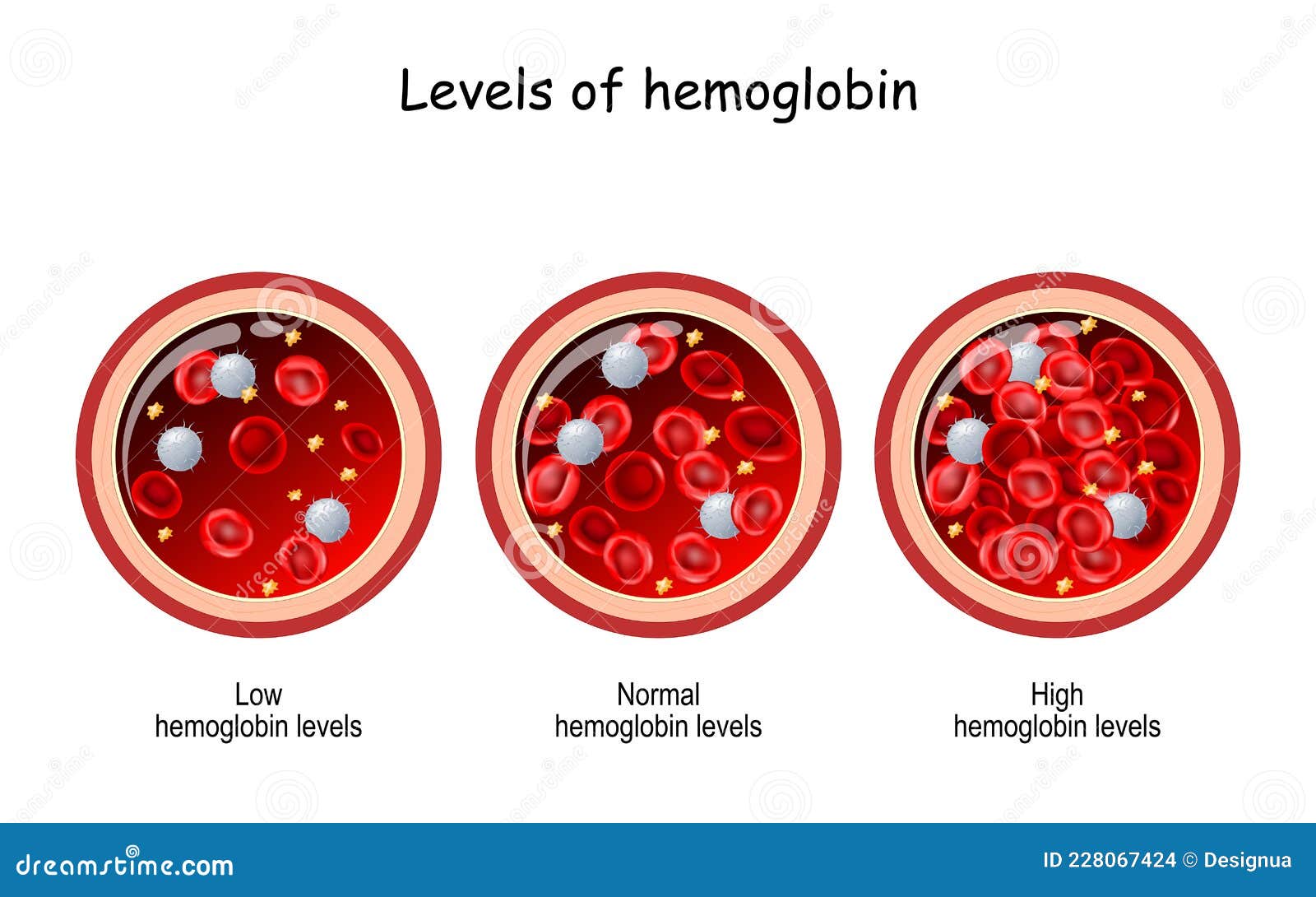 Range hemoglobin normal Hemoglobin