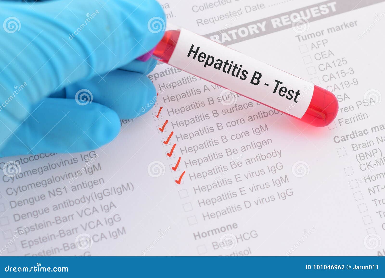 Hepatitis B test stock photo. Image of antigen, fever 101046962