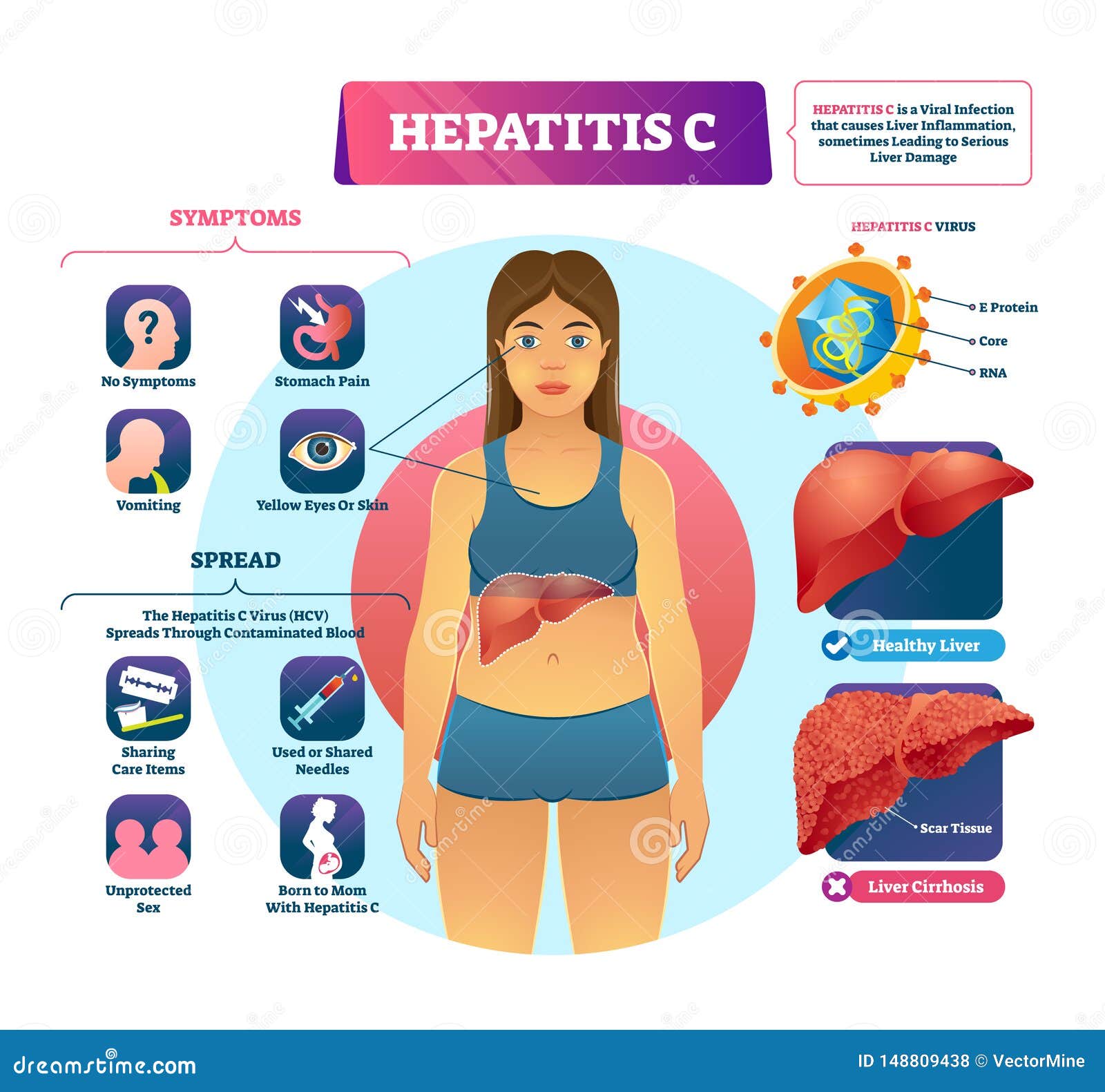 C symptoms hepatitis What Are