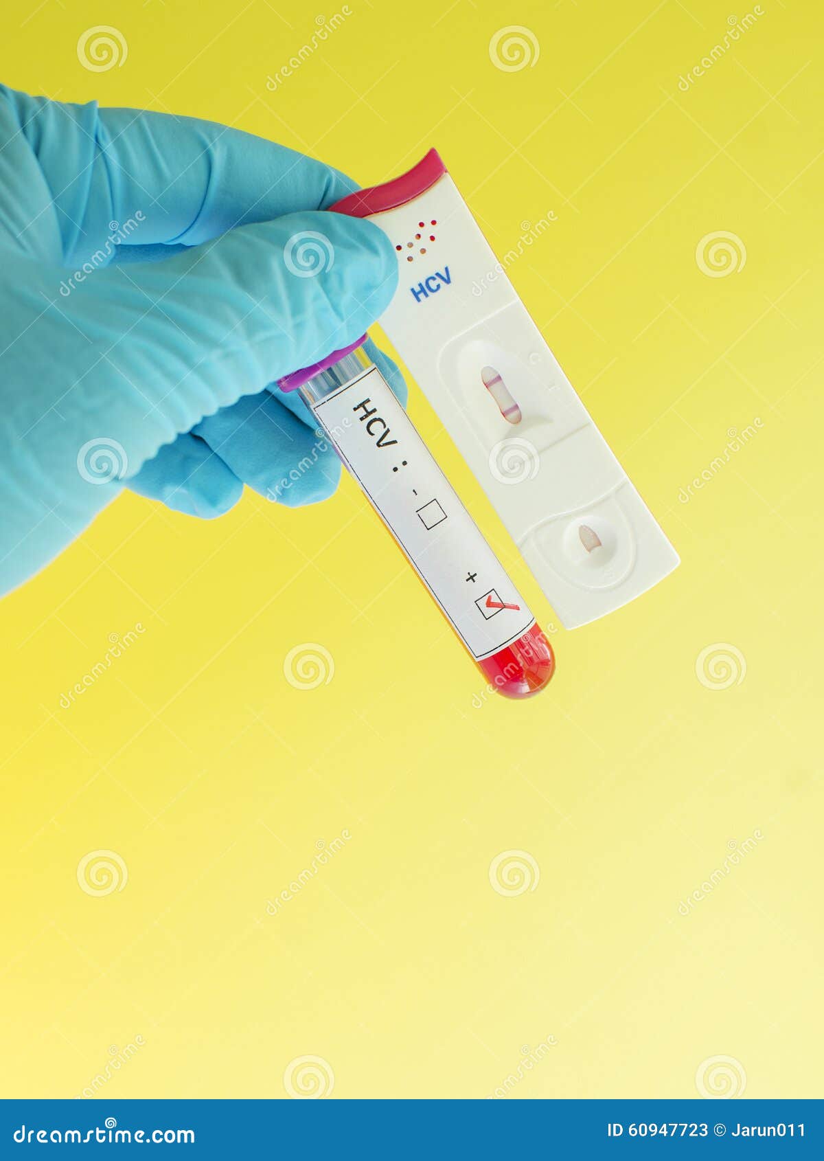 c test blood hep Stock  (HCV) Hepatitis 60947723 Image C  Positive Virus Image:
