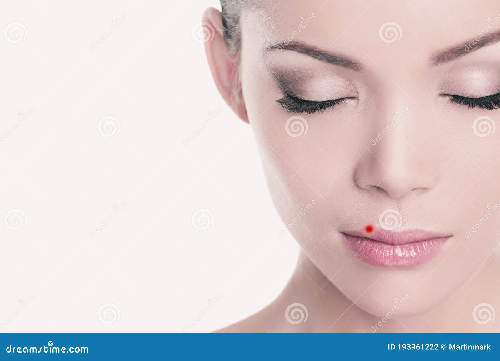 https://thumbs.dreamstime.com/z/herpes-red-circle-area-lips-asian-beauty-woman-model-portrait-girl-cold-sore-design-oral-health-problem-concept-193961222.jpg