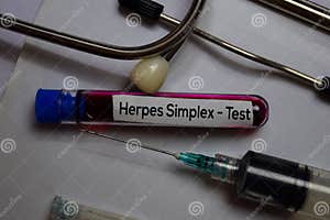 Herpes Simplex Test With Blood Sample Top View Isolated On Office Desk Stock Photo Image Of Herpes Simplex Test With Blood Sample Top View Isolated On Office Desk Stock Photo Image Of