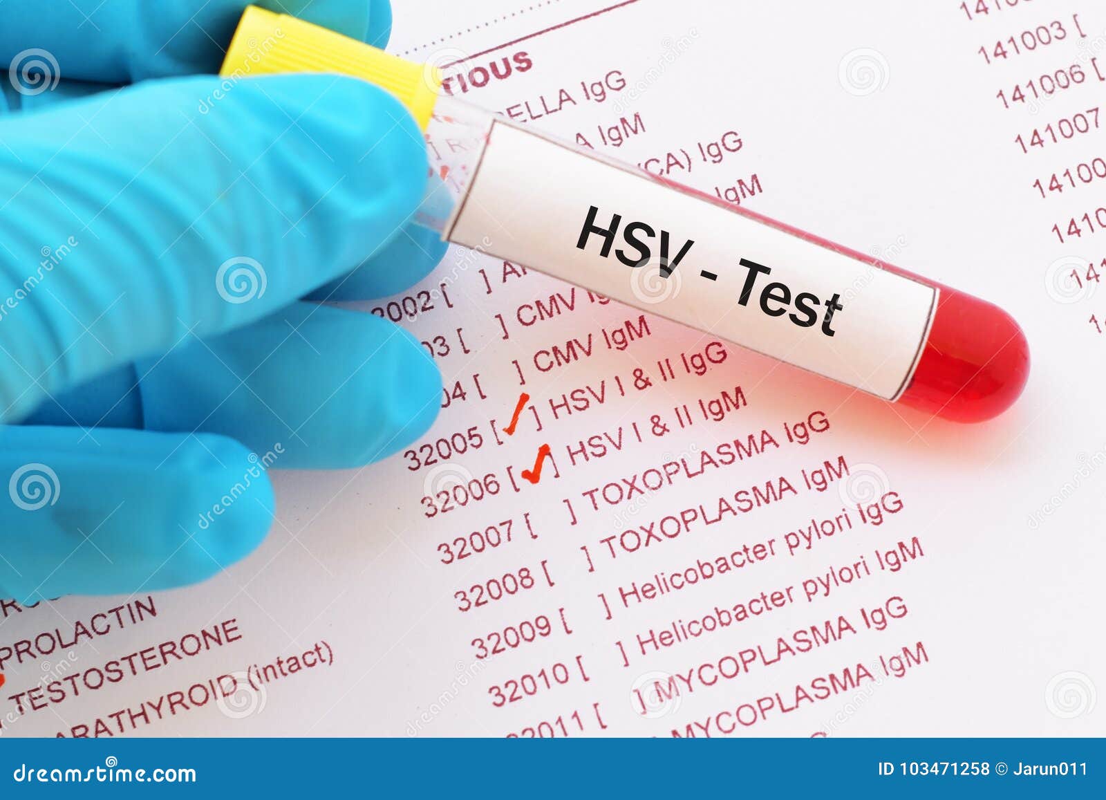 herpes-simplex-virus-test-stock-photo-image-of-health-103471258