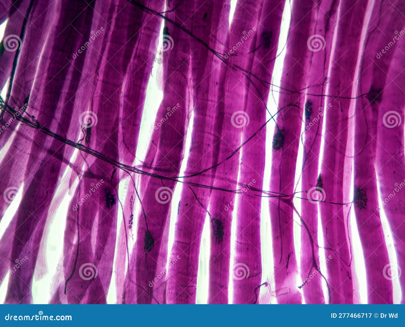Neuromuscular Junction Skeletal Muscle And Motor Neuron Stock Photo neuromuscular-junction-skeletal-muscle-and-motor-neuron-stock-photo
