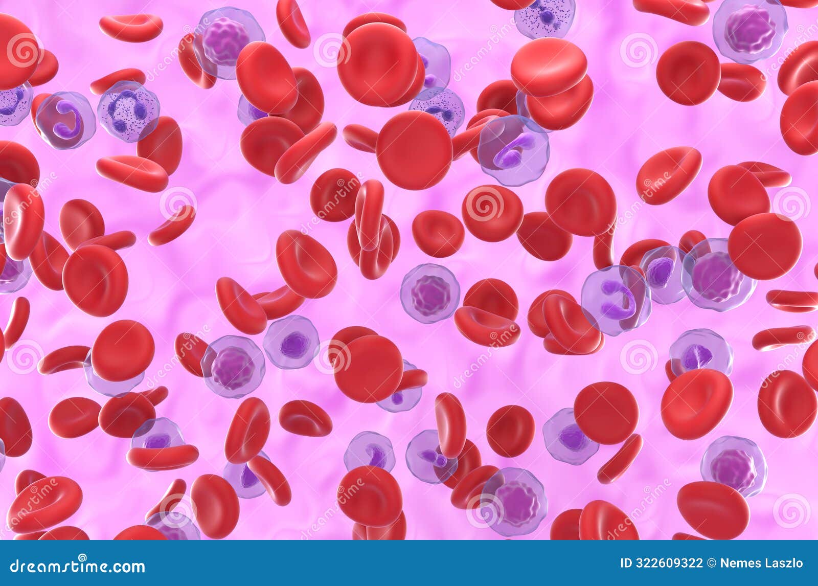 high level of red blood cell in polycythemia vera (pv) - isometric view 3d 