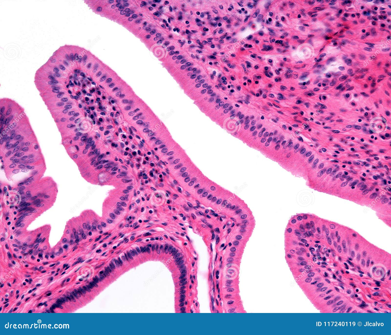 simple columnar epithelium. ampulla of vater