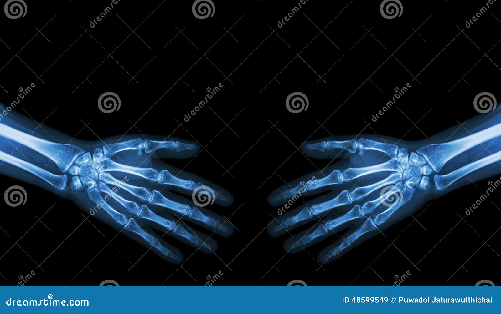 Highen för händer 3d framför upplösningsshake Normala mänskliga händer för röntgenstråle (tomt område på övresidan). Highen för händer 3d framför upplösningsshake Normala mänskliga händer för röntgenstråle (tomt område på övresidan)
