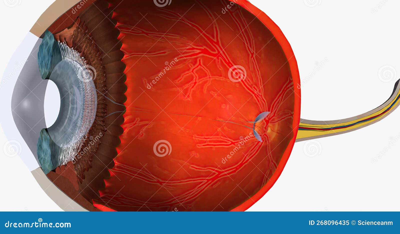 Higher Than Normal Intraocular Pressure in the Absence of Ocular