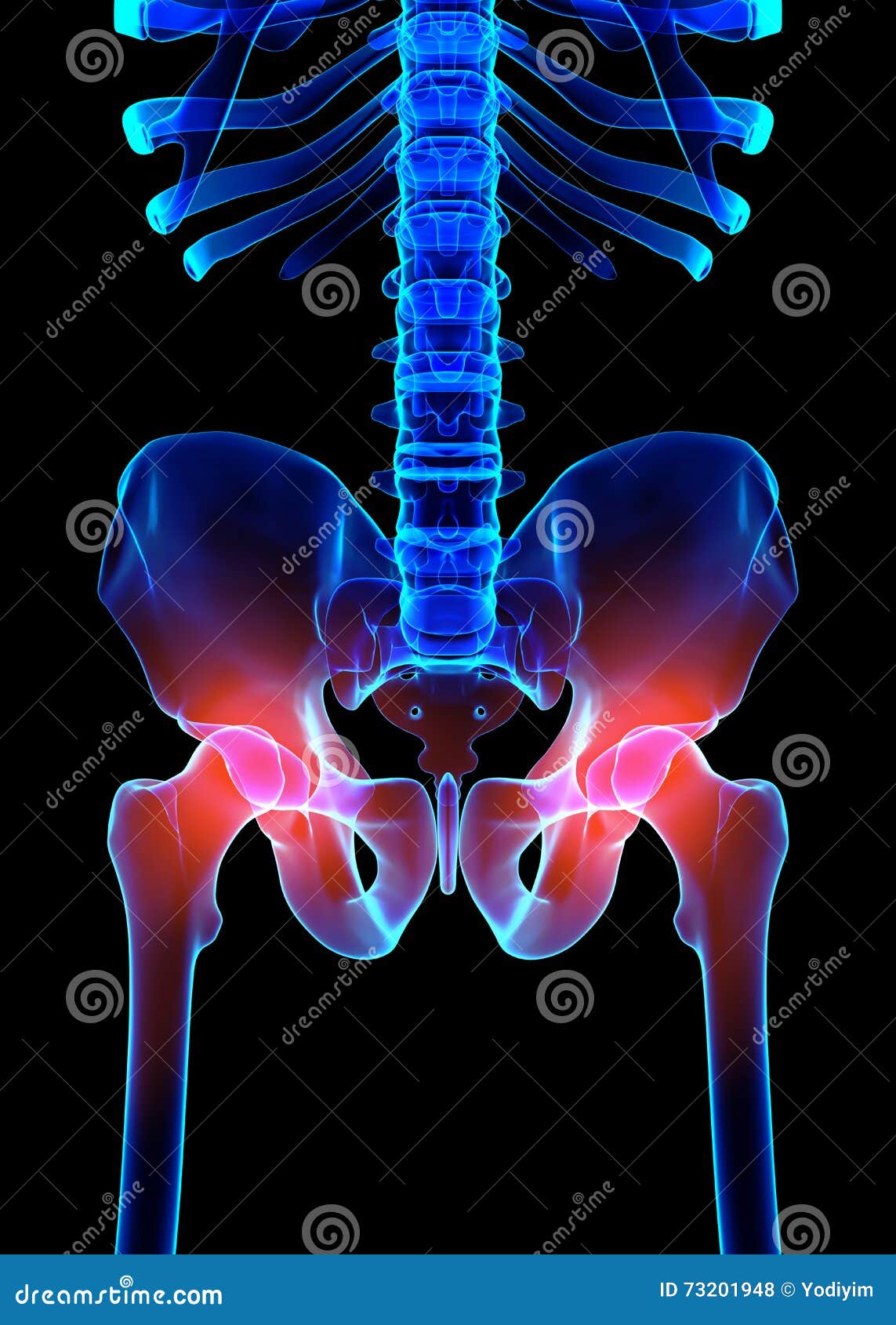 Hip Painful Skeleton X Ray 3d Illustration Stock Illustration