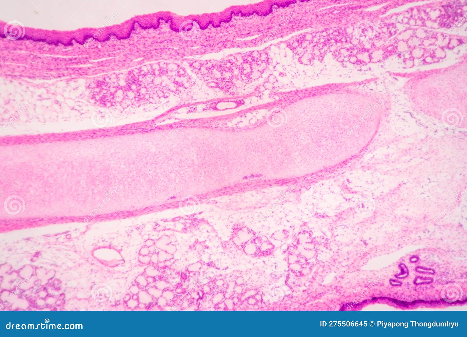 Histological Bone, Elastic Cartilage Human and Joint of Human Foetus