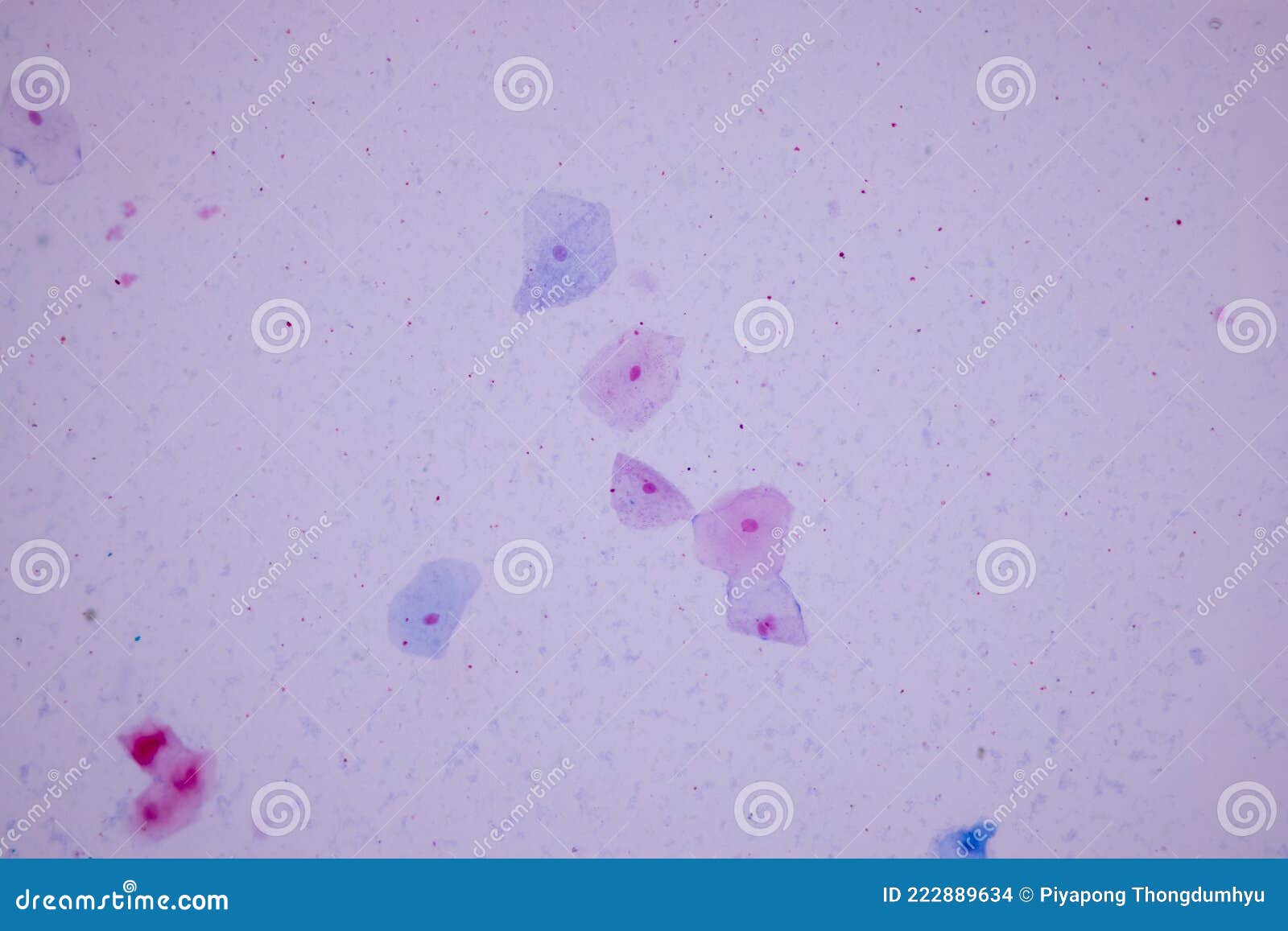 Histological Sample Squamous Epithelial Cells Under Microscope. Stock