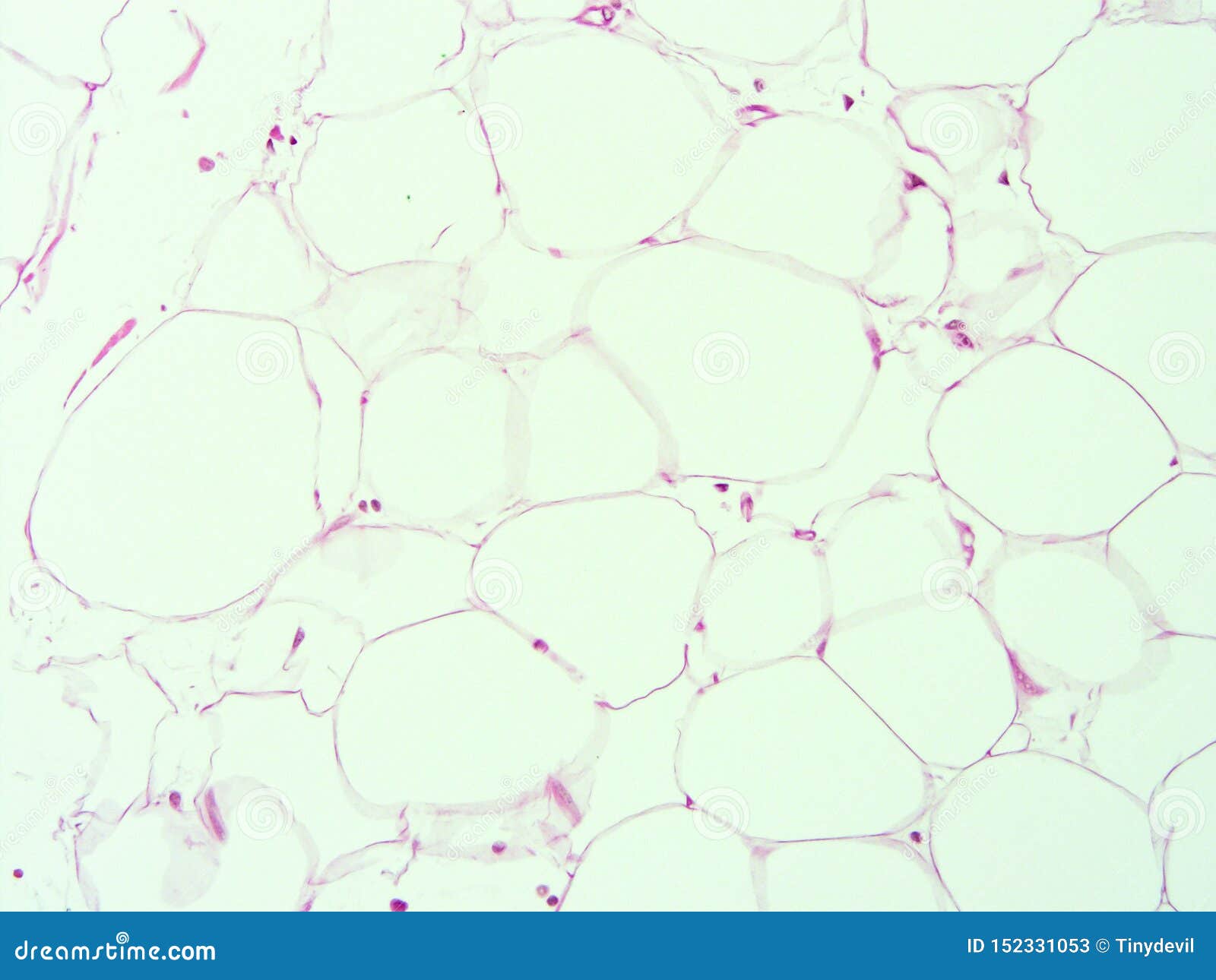 histology of human adipose tissue
