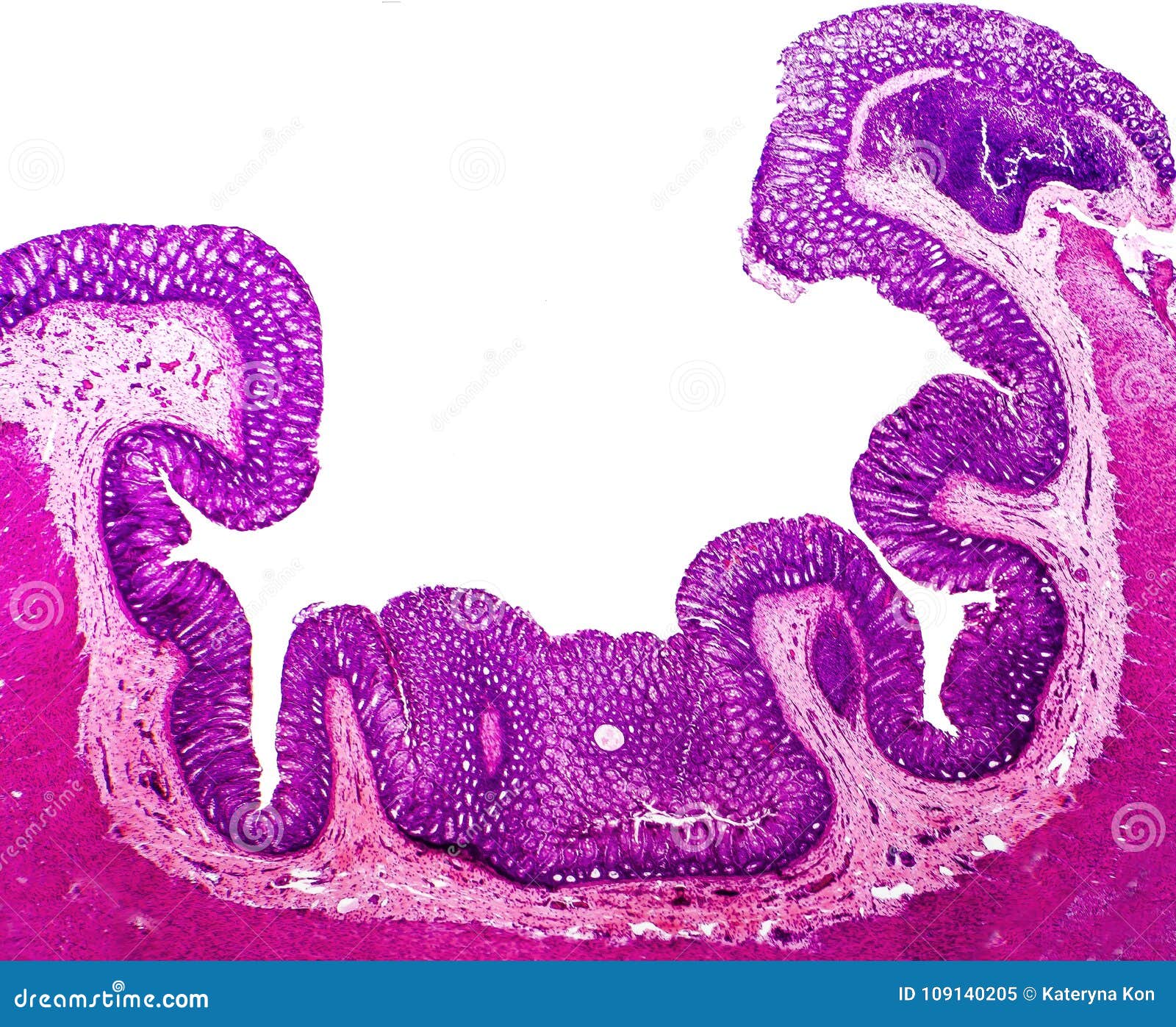 histology of human appendix, micrograph showing crypts of lieberkuhn