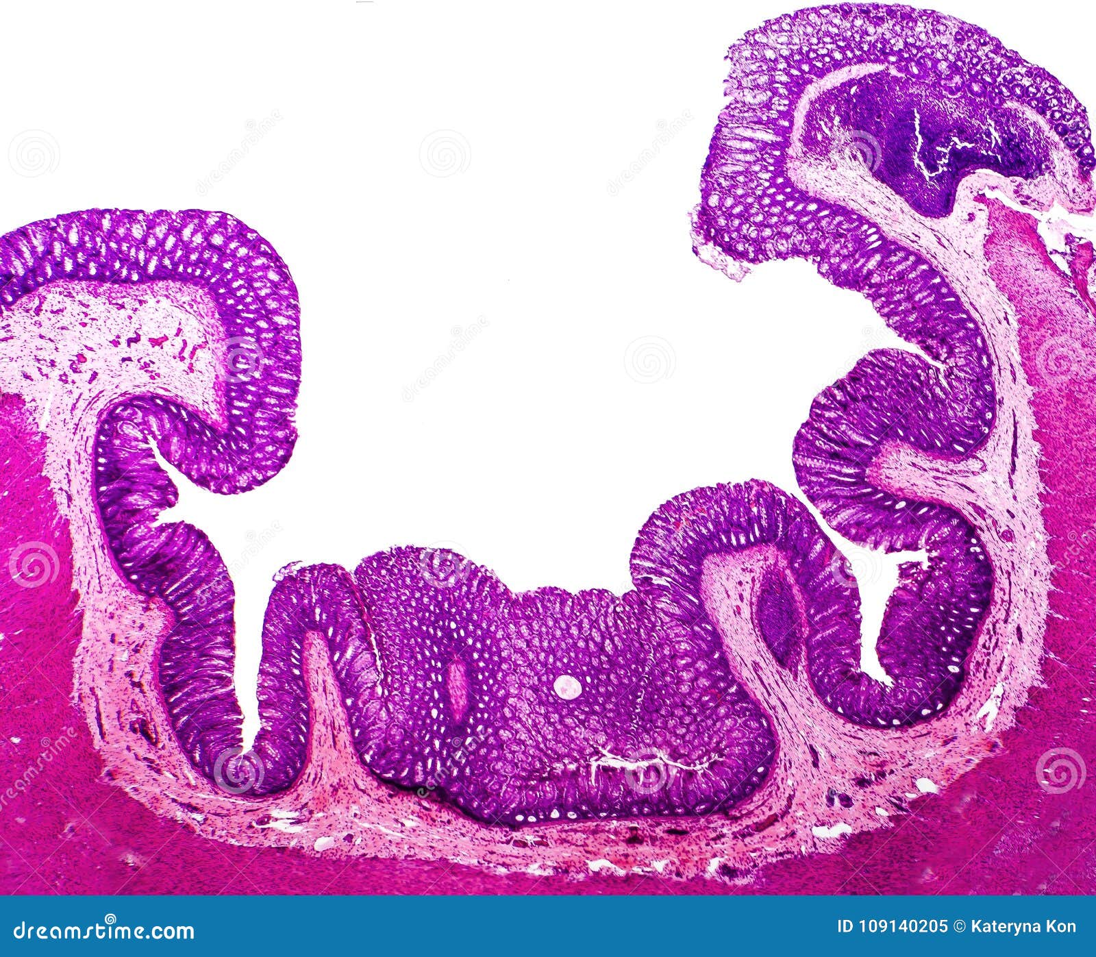 Histology of the appendix stock photo cartoondealer 44133822