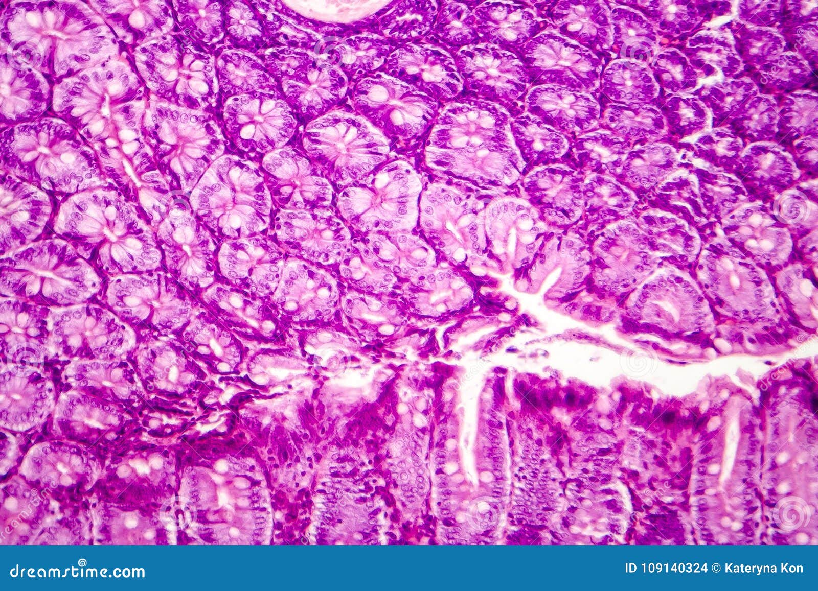 Histology of the appendix stock photo cartoondealer 44133822