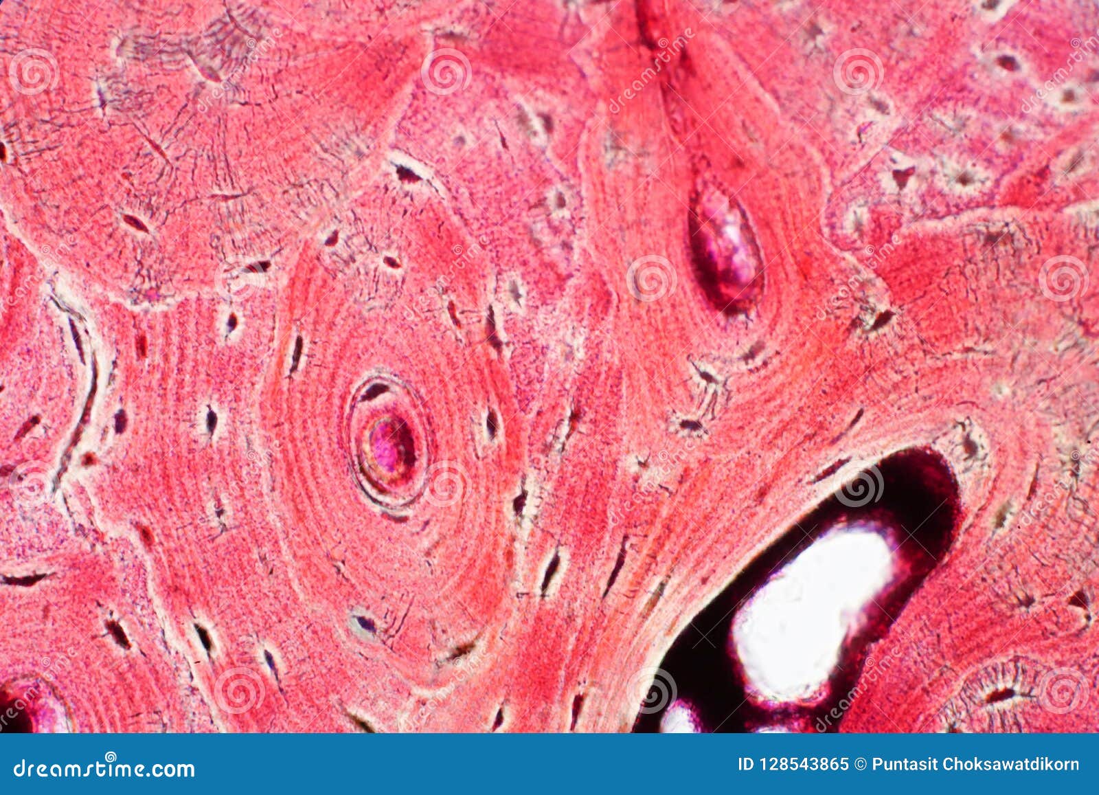 histology of human compact bone tissue under microscope view for