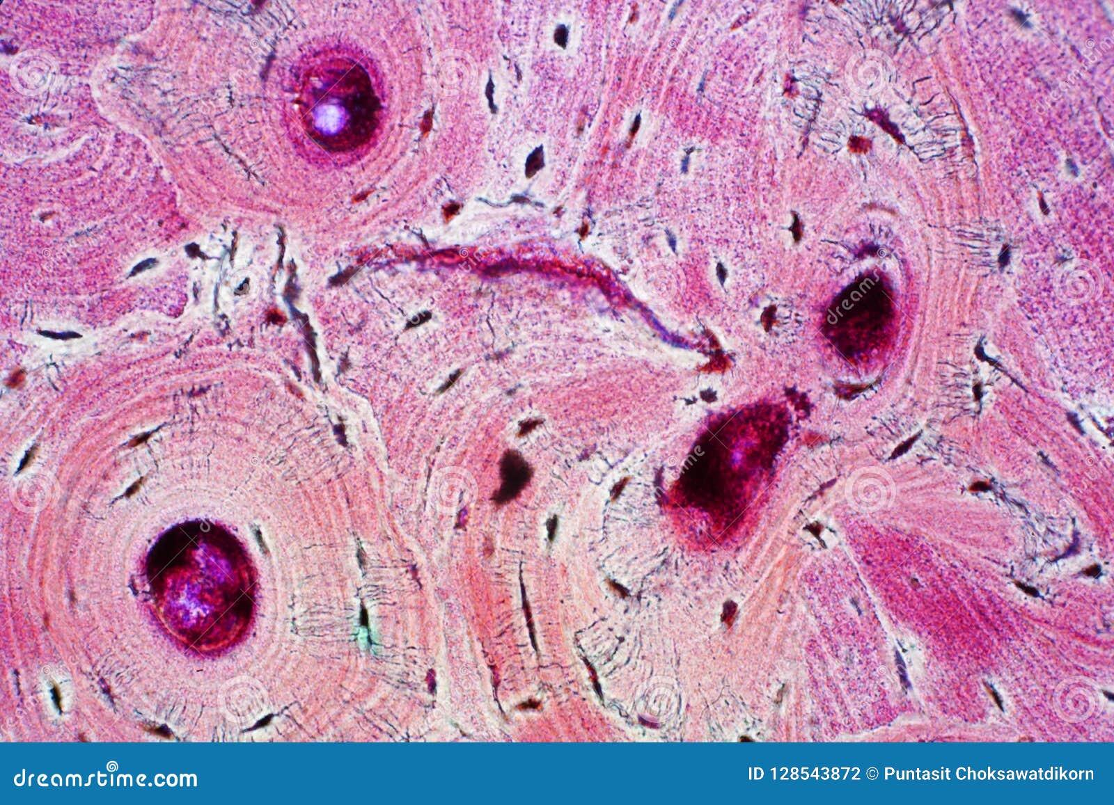 histology of human compact bone tissue under microscope view for