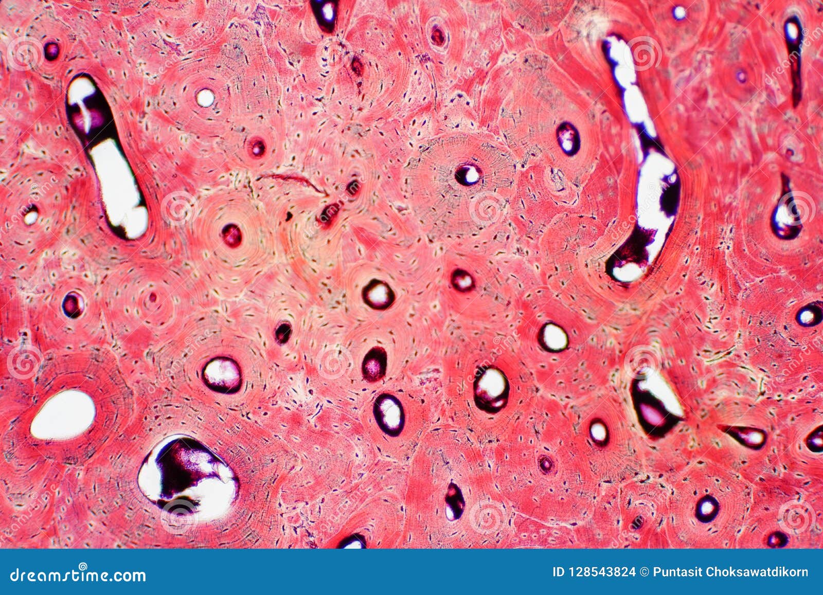 histology of human compact bone tissue under microscope view for