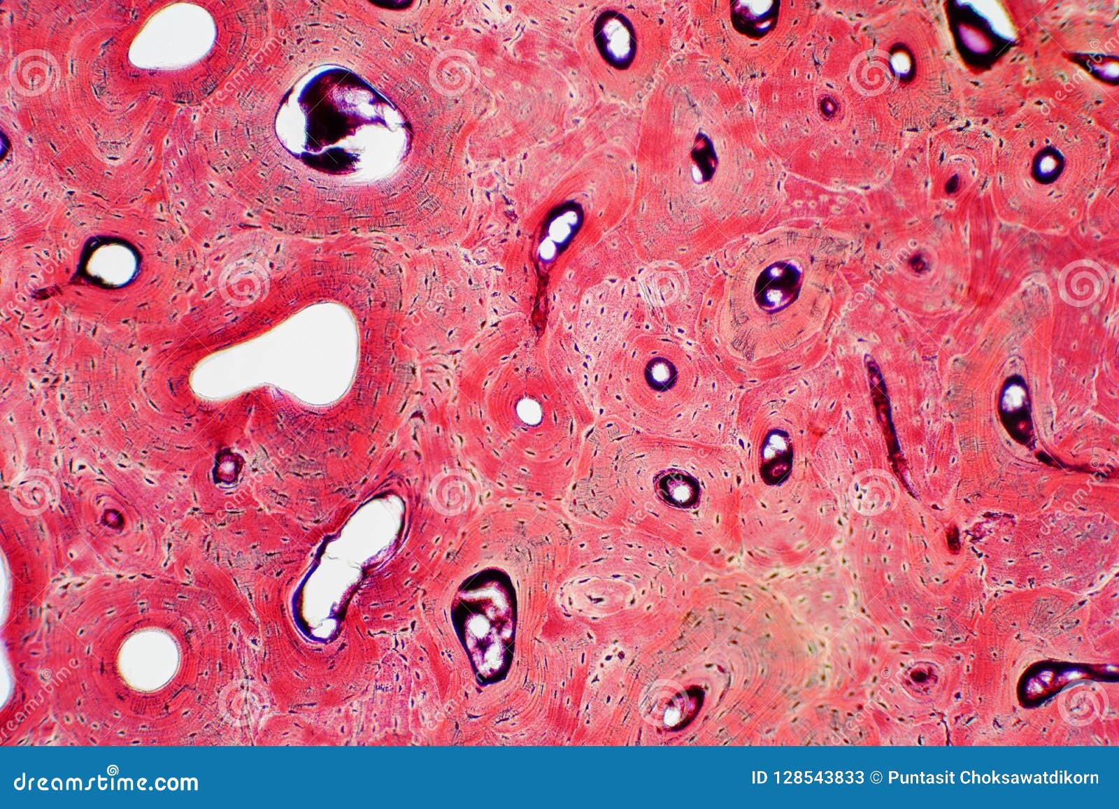 histology of human compact bone tissue under microscope view for