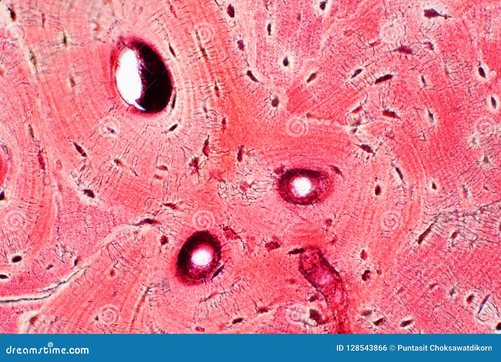 histology of human compact bone tissue under microscope view for