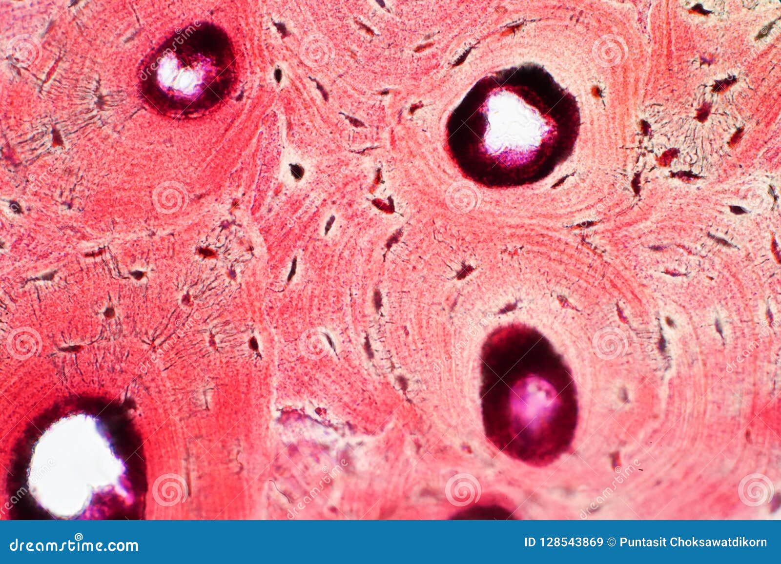 Histology of human compact bone tissue under microscope view for stock