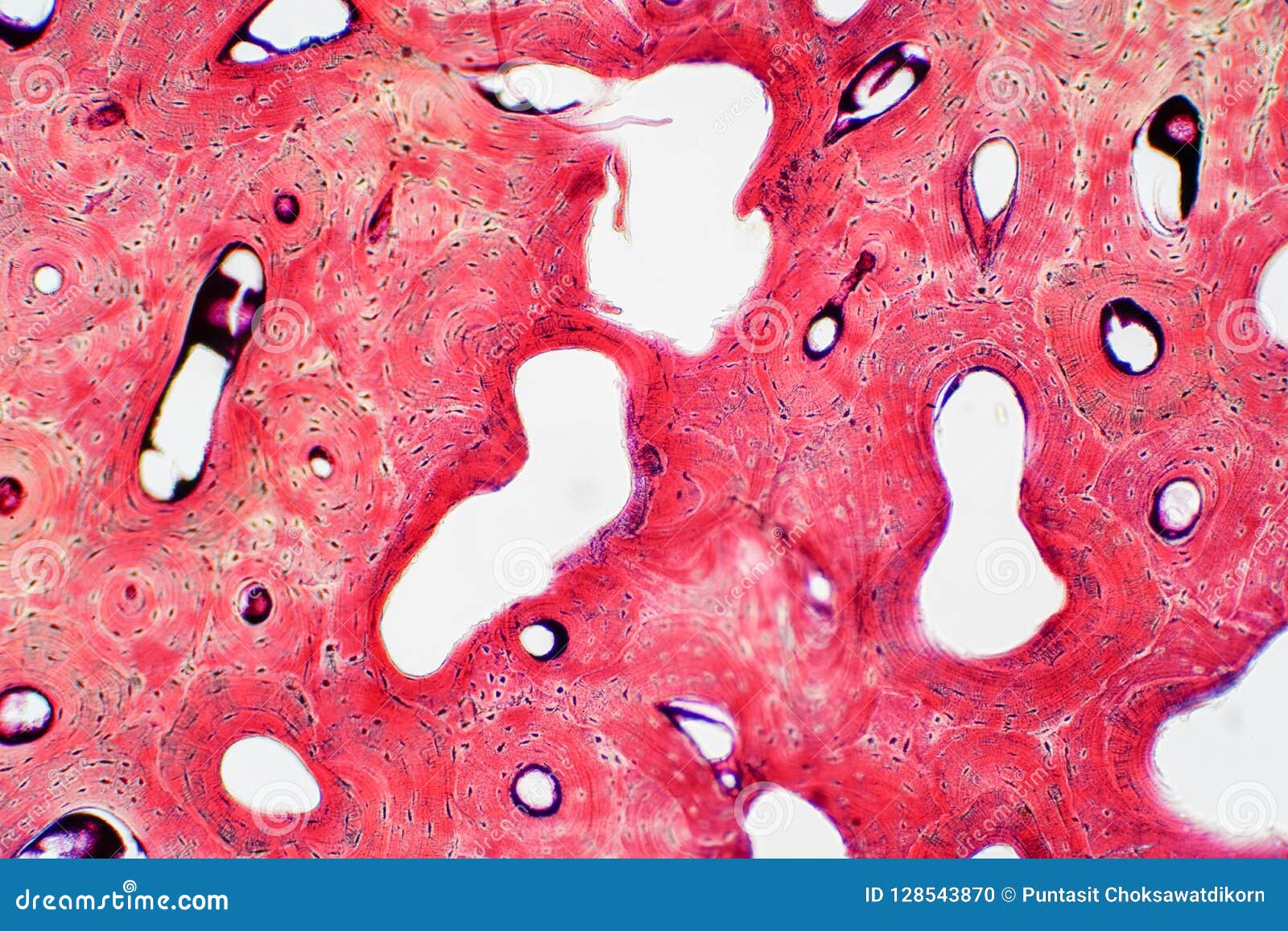 histology of human compact bone tissue under microscope view for
