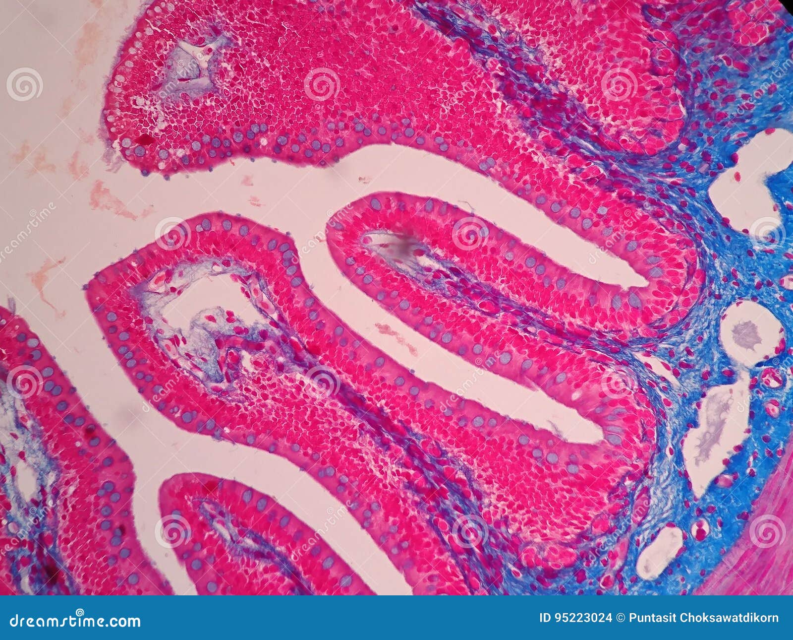 histology of human intestine tissue