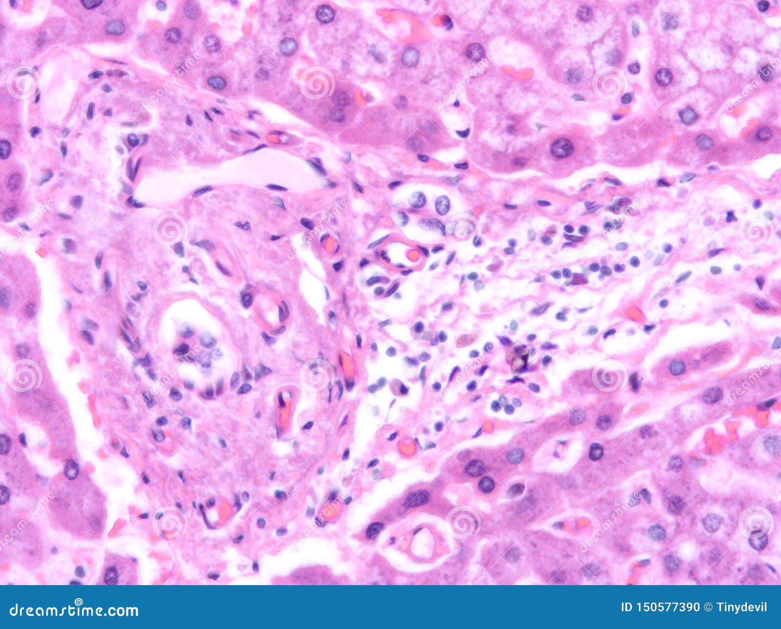 Histology of Human Liver Tissue Stock Photo Image of medical, health 150577390