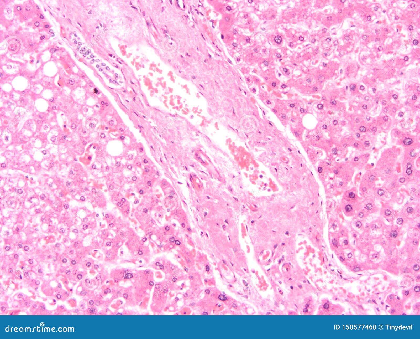Histology of Human Liver Tissue Stock Photo Image of microscope, gland 150577460