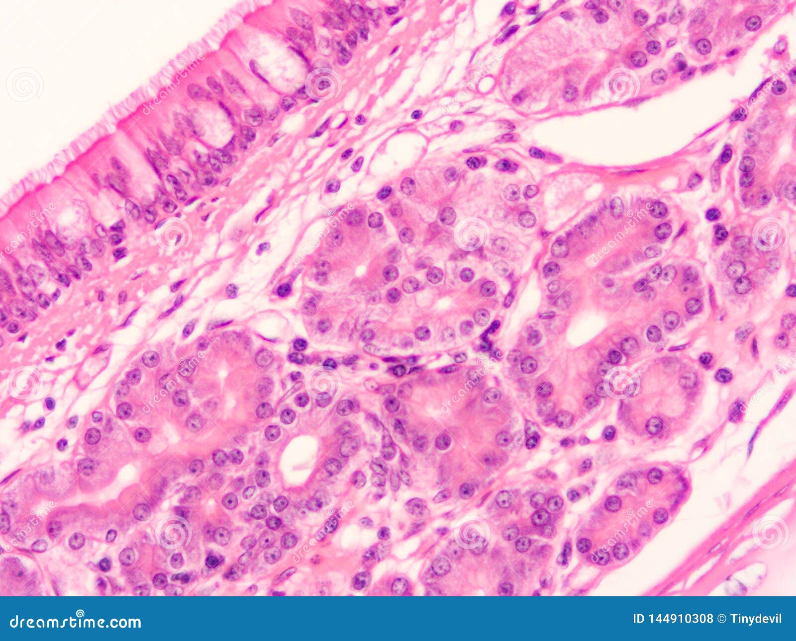 Histology Of Trachea Human Tissue Stock Photo - Image of research