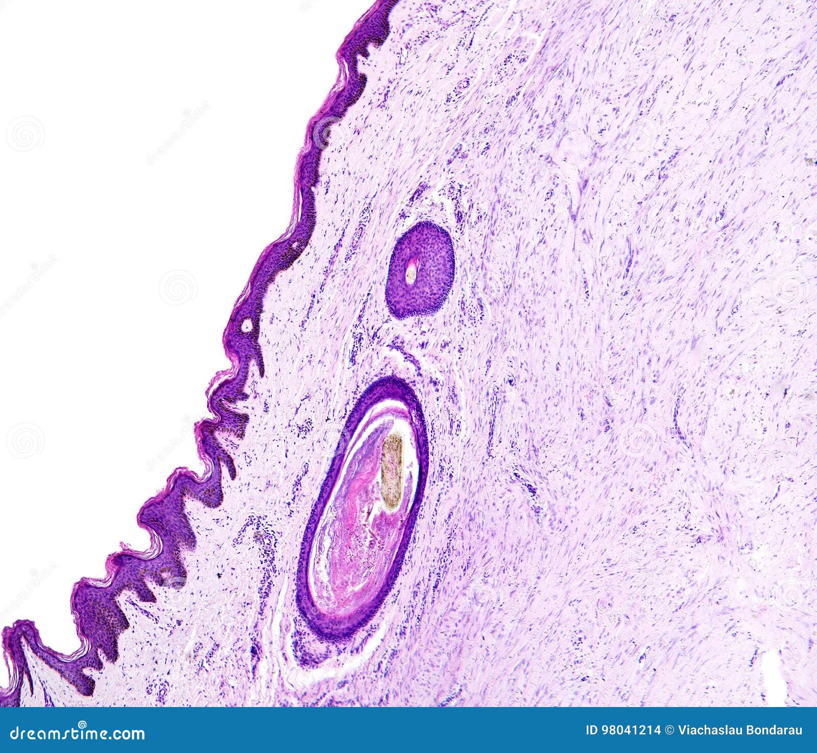 histology of human tissue, show skin with hair follicles as seen under the microscope.