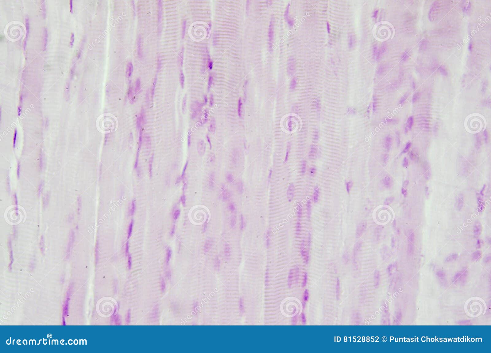 histology of skeletal muscle