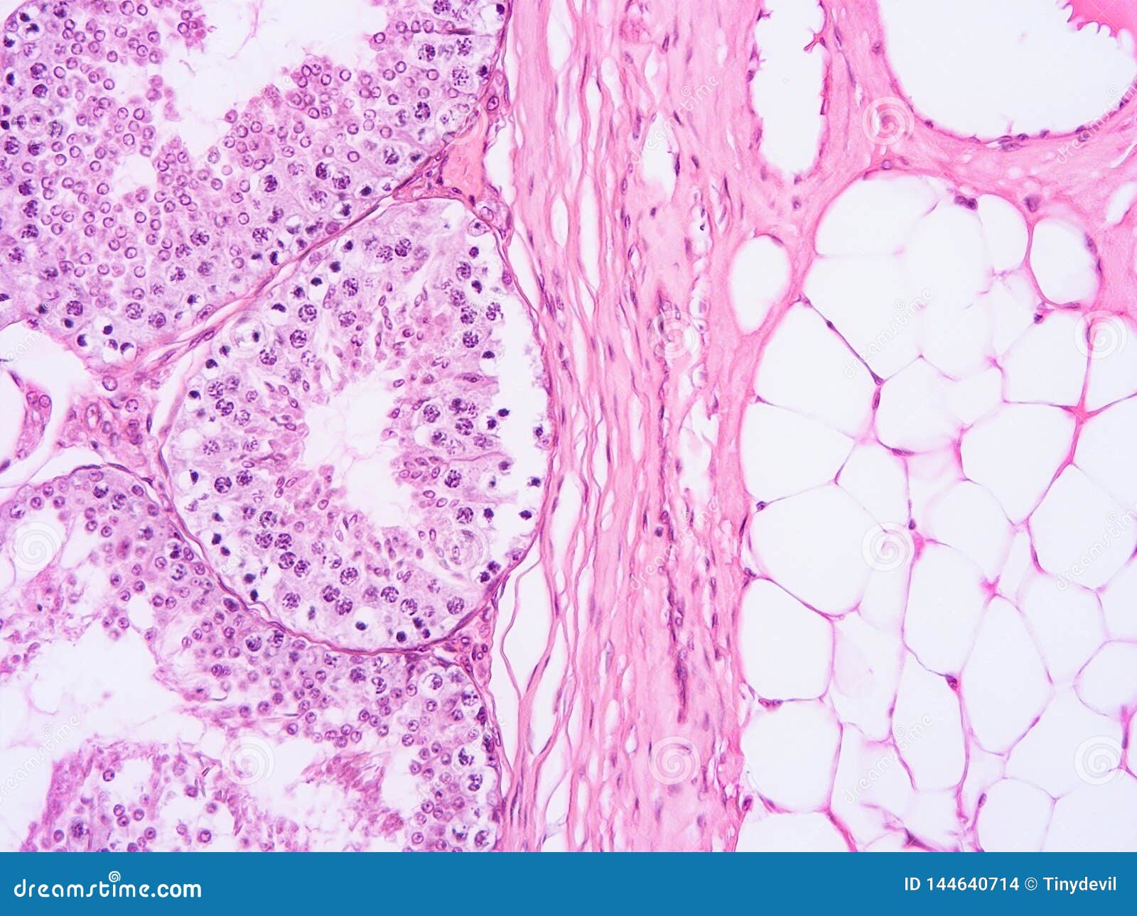 Bulbourethral Gland Histology