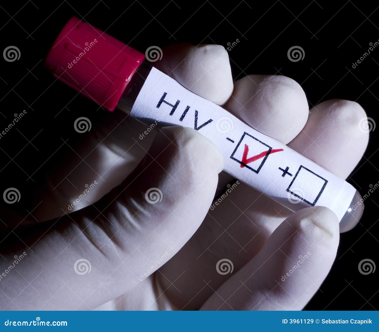 HIV negative stock image. Image of medical, danger, label 3961129