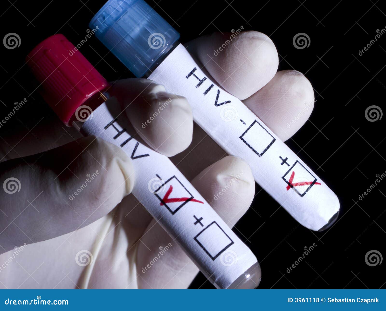 hiv positive and negative