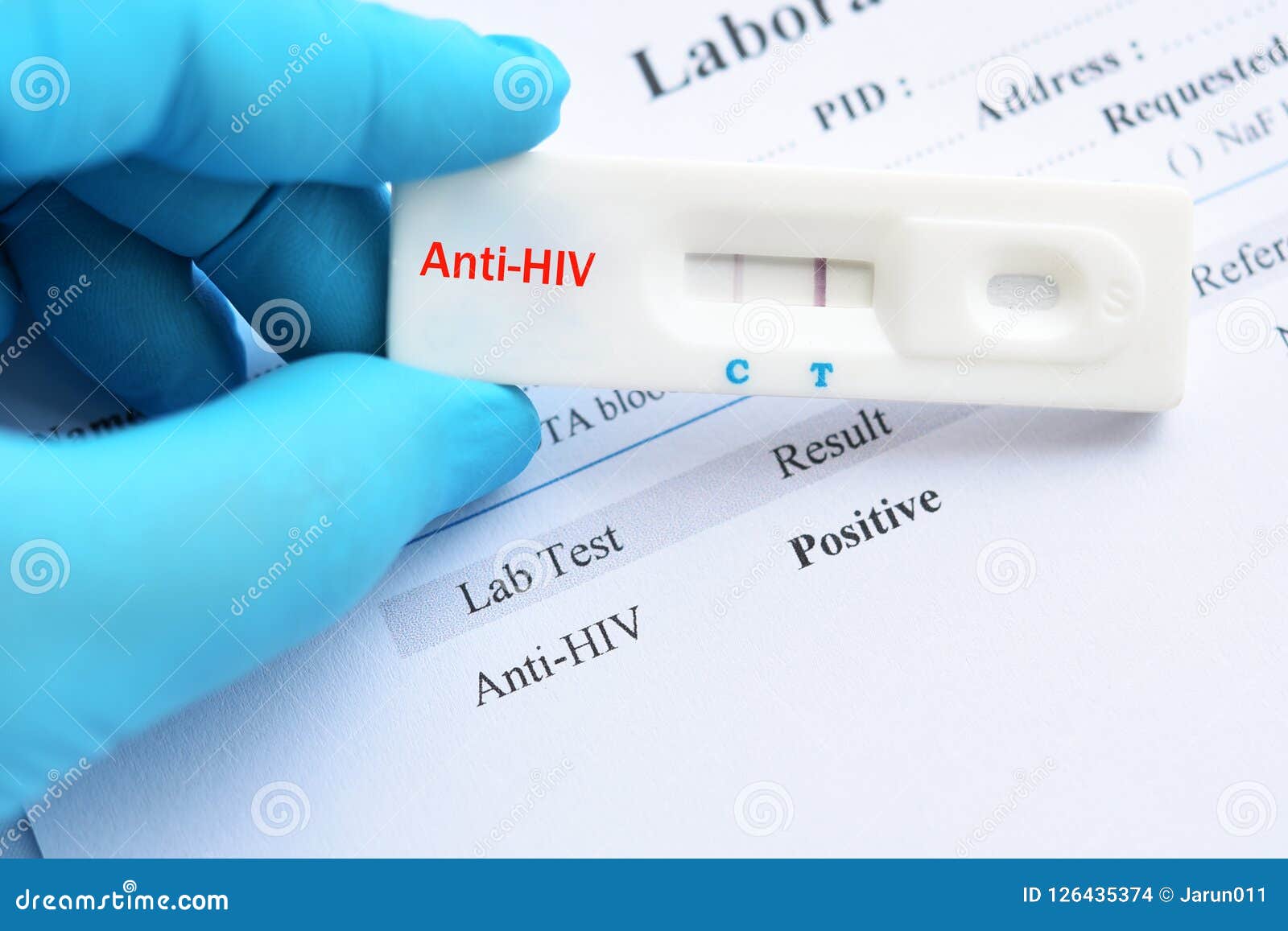 HIV positive test result stock photo. Image of health - 126435374