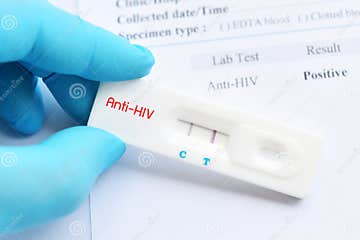 HIV Positive Test Result Stock Image Image Of Health 123833419