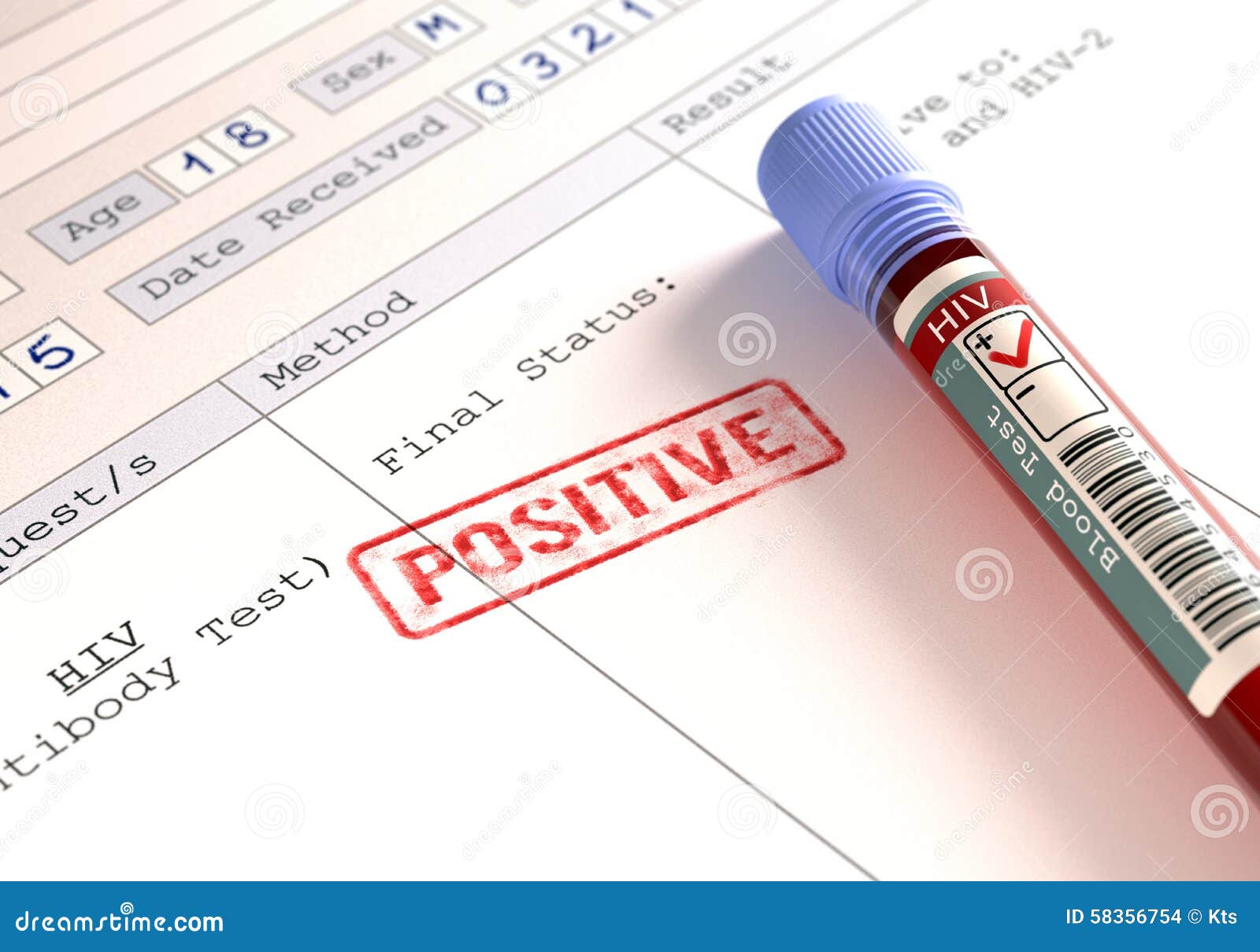 HIV Positivo Fotografia Stock Immagine Di Reattivo Malattia 58356754 hiv-positivo-fotografia-stock-immagine-di-reattivo-malattia-58356754