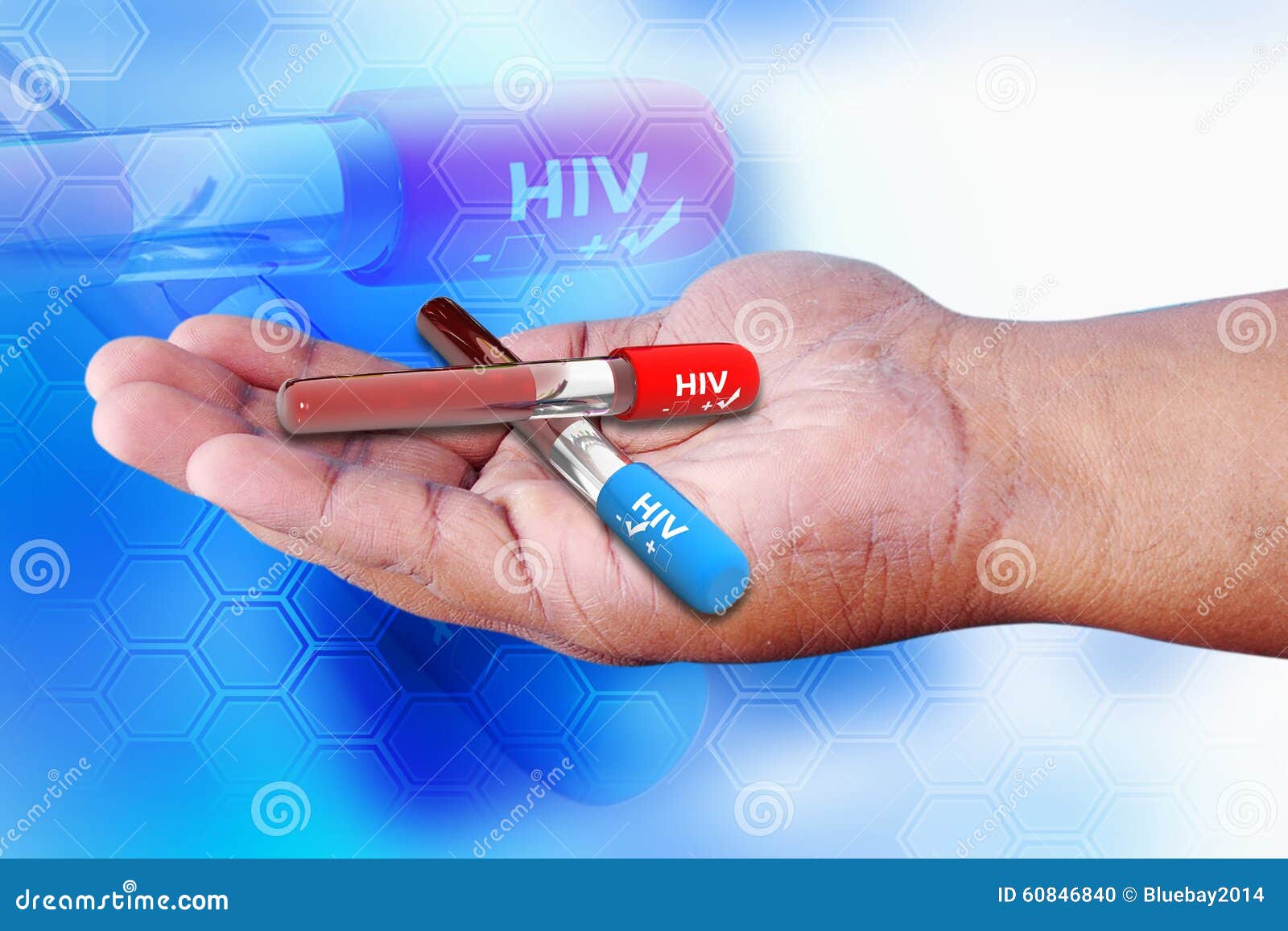如何分辨HIV试纸的弱阳和包埋线? - 知乎