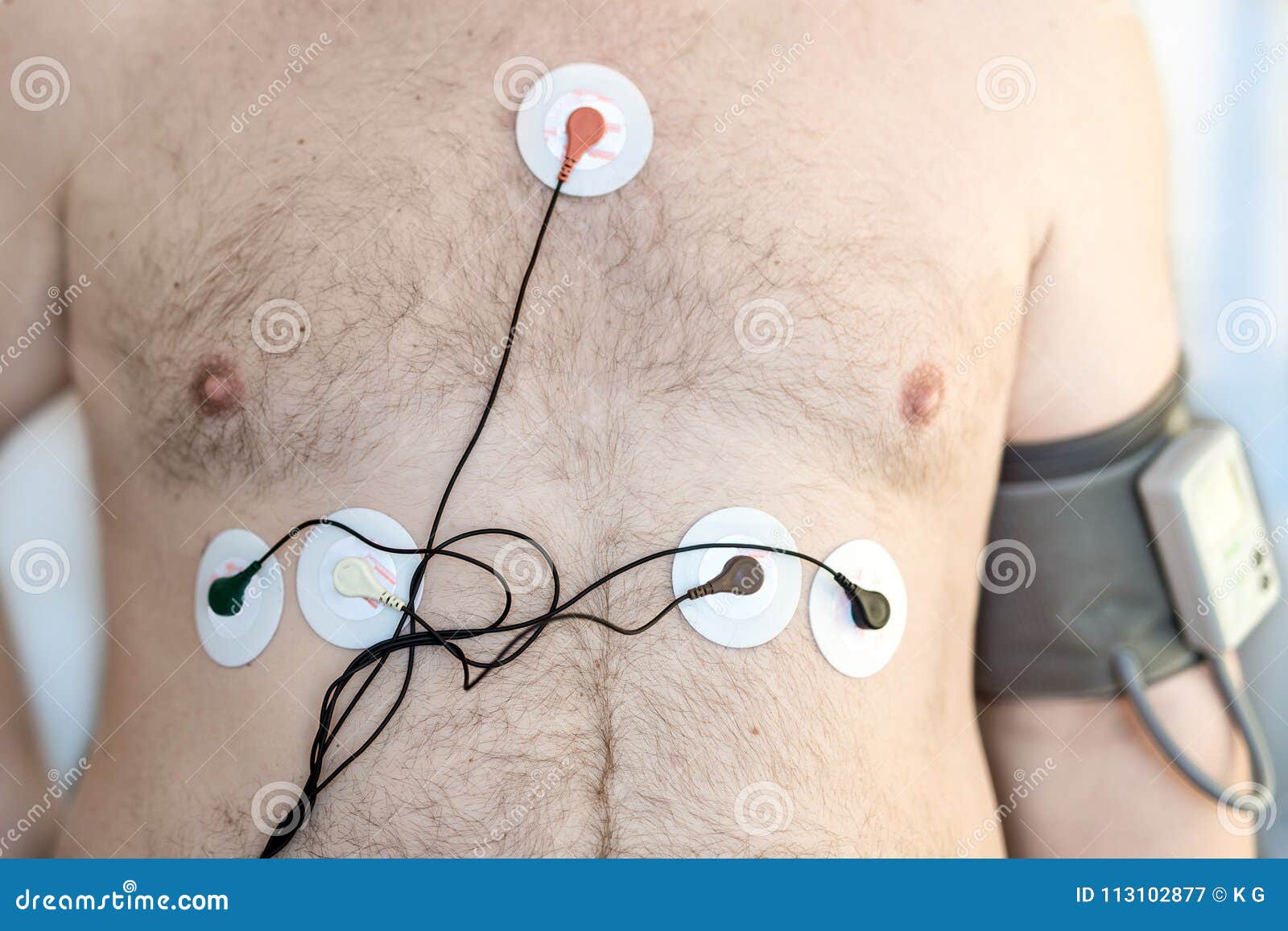 https://thumbs.dreamstime.com/z/holter-monitor-device-blood-pressure-recorder-human-male-body-cardiogram-monitoring-overweight-person-high-risk-113102877.jpg