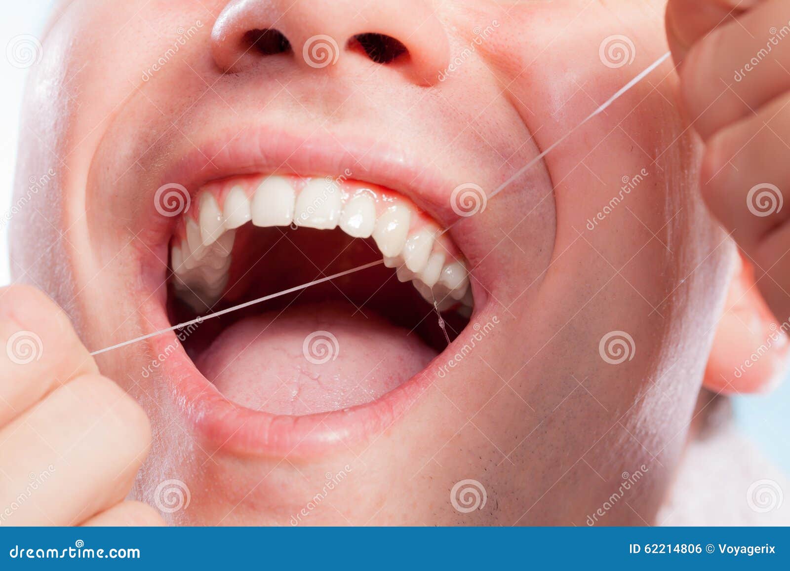 Resultado de imagem para fio dental aplicado aos dentes