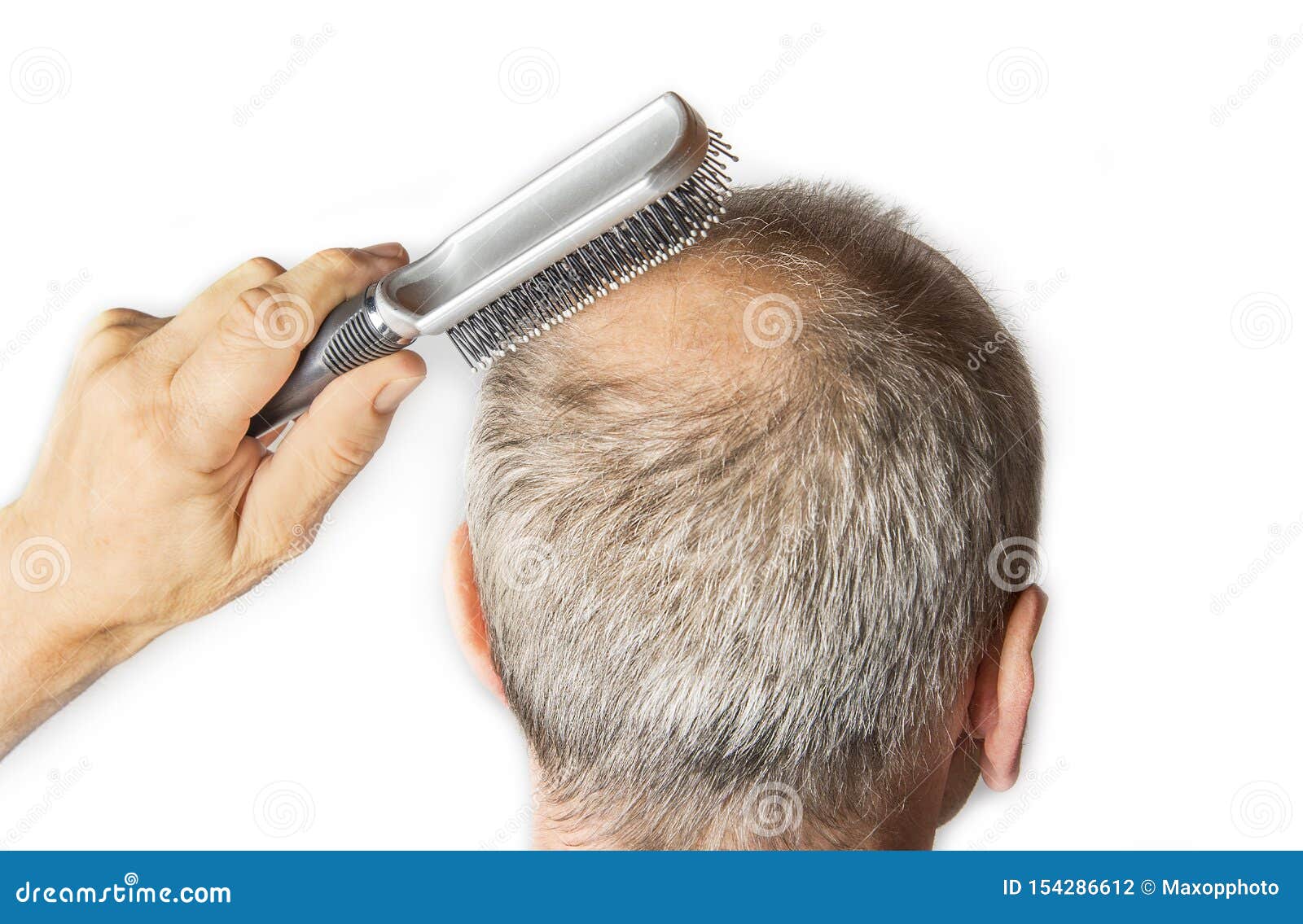 Homme Chauve Avec Le Peigne Concept De Perte Des Cheveux Image stock -  Image du coiffure, regarder: 154286633