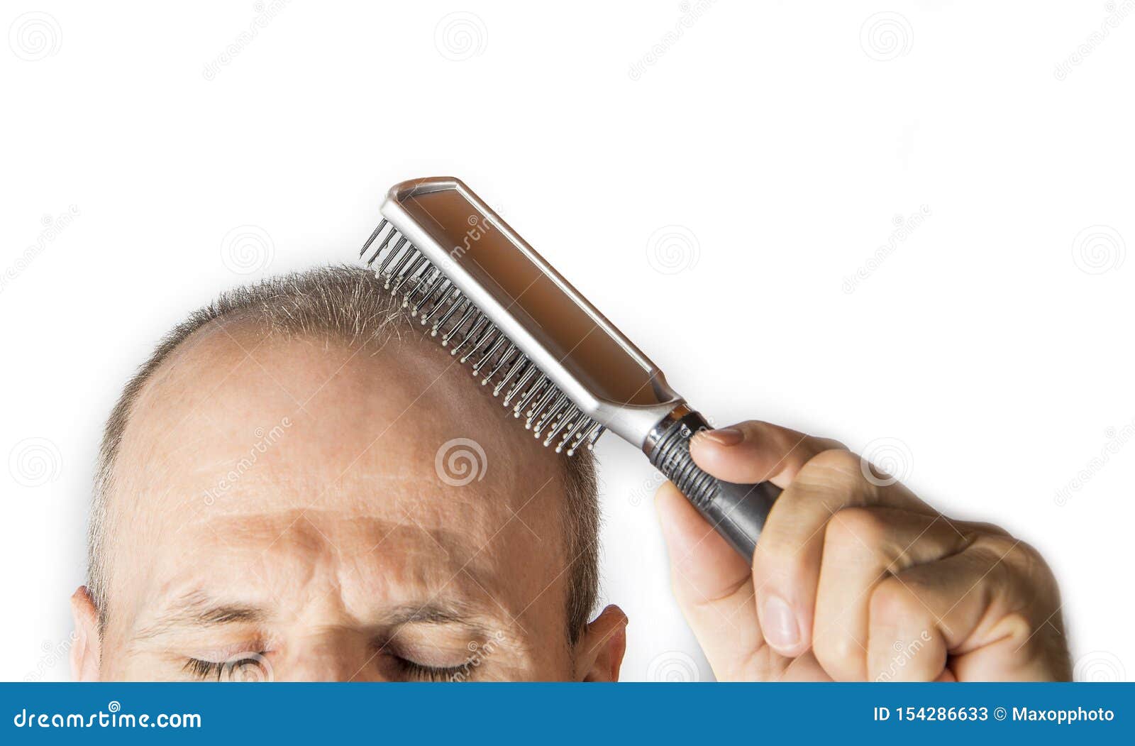 Homme Chauve Avec Le Peigne Concept De Perte Des Cheveux Image stock -  Image du coiffure, regarder: 154286633