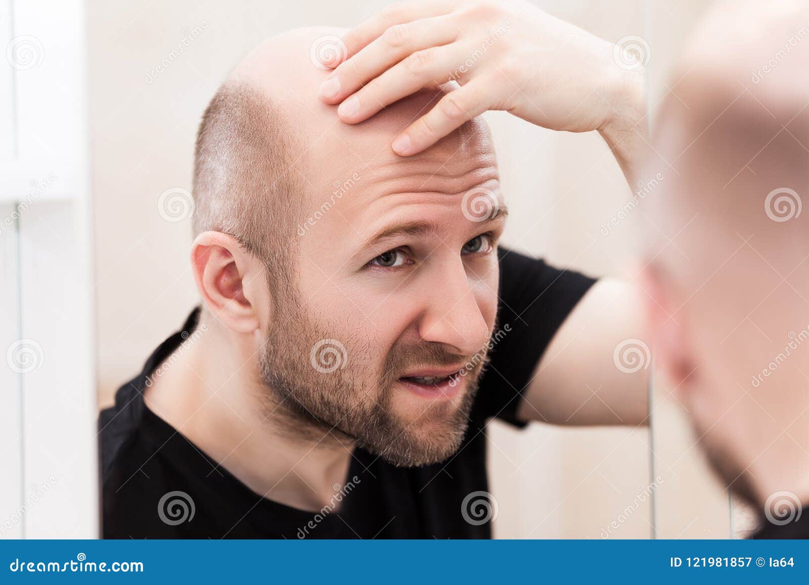 Concept De Perte De Cheveux. Jeune Homme Chauve Avec Une Brosse à Cheveux  Sur Fond Blanc. Photo stock - Image du visage, calvitie: 216259972