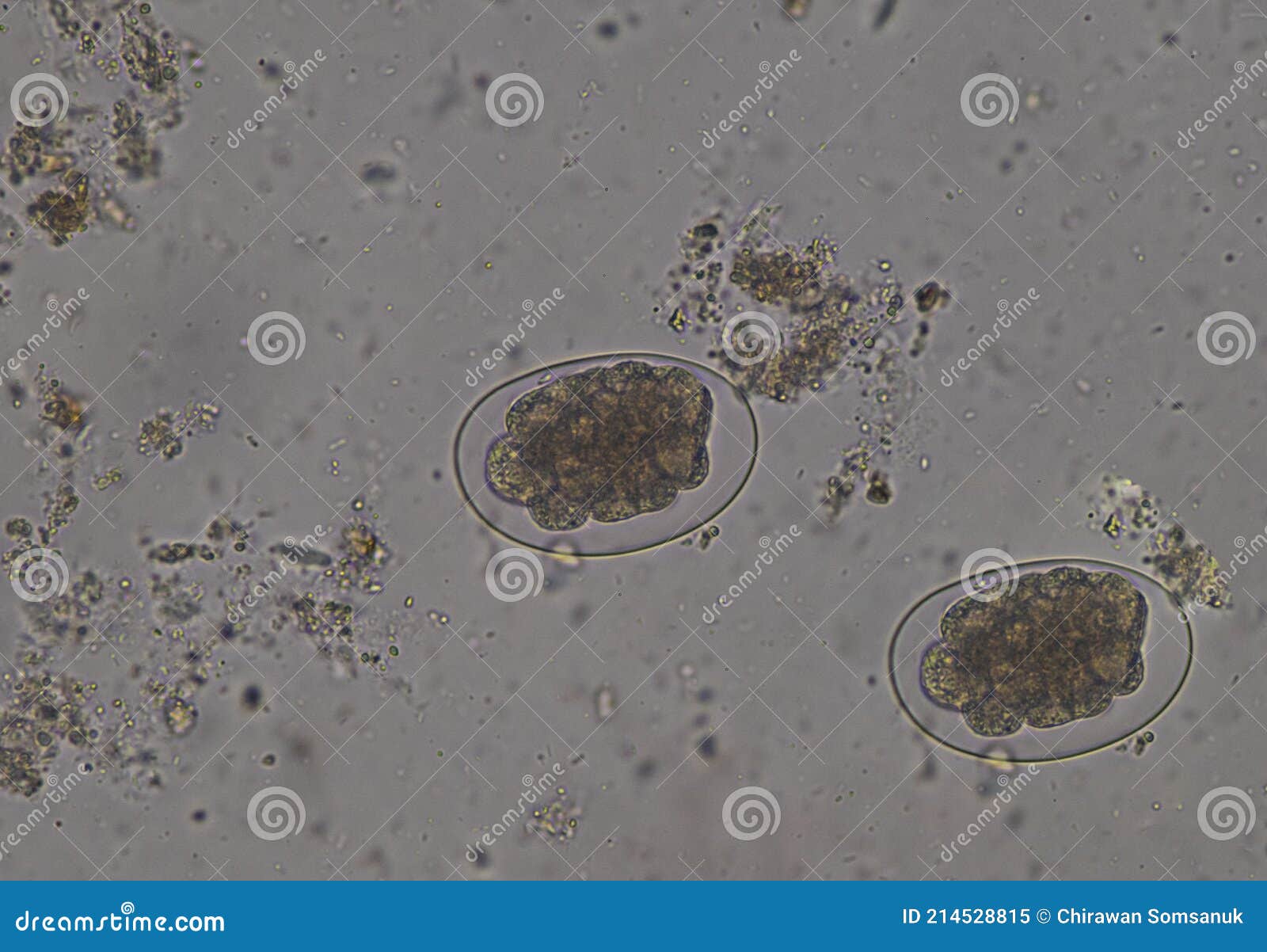 Hook worm eggs of pasasite stock image. Image of analyzing - 214528815