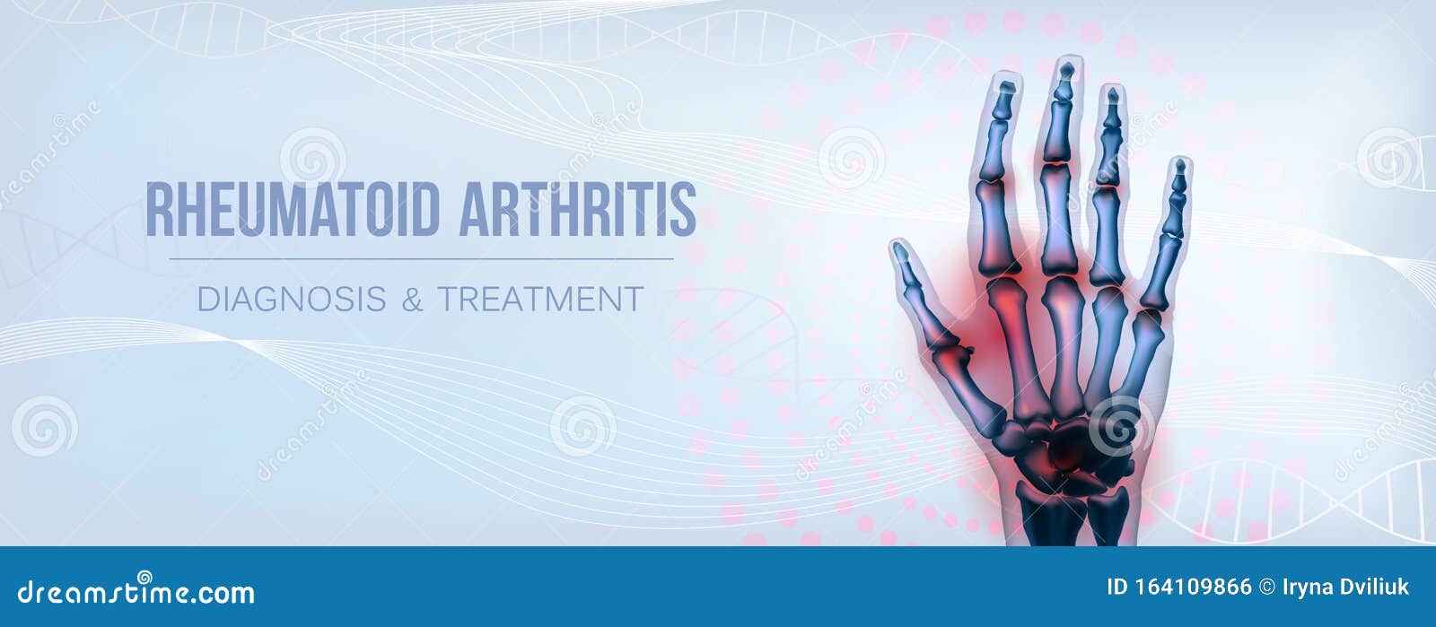 horizontal rheumatoid arthritis hand sore joints concept for social media