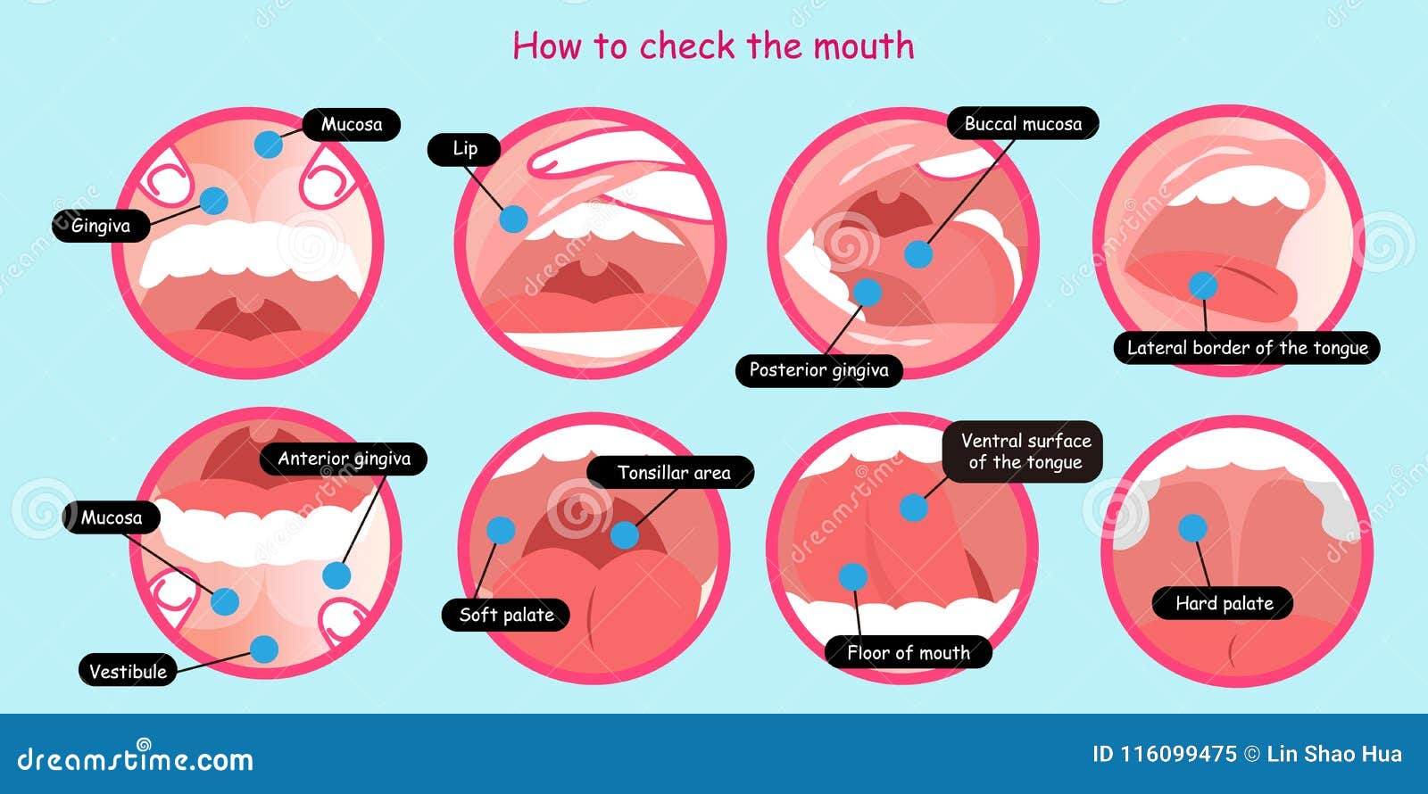 How To Check The Mouth Stock Illustration Illustration Of Caricature
