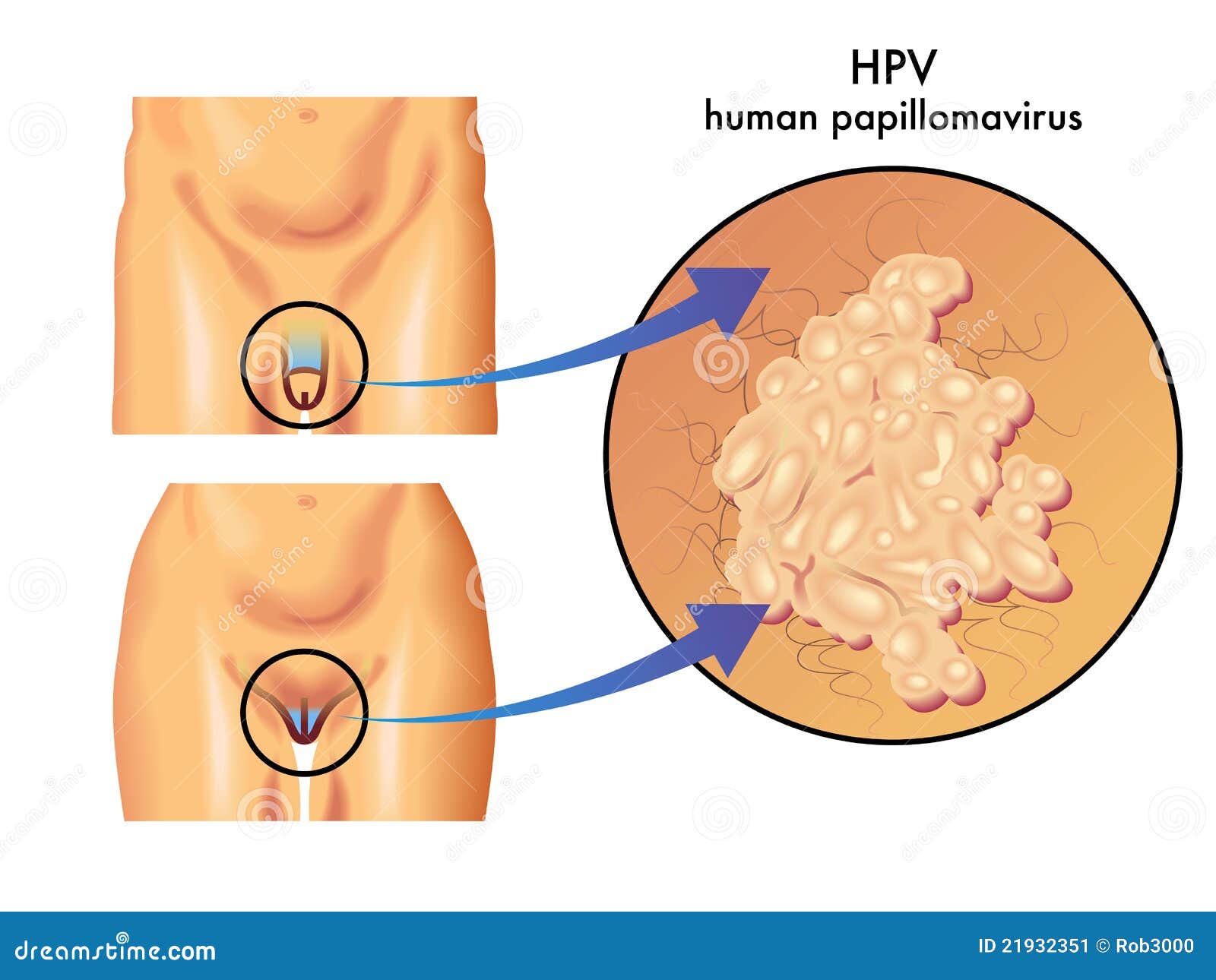 hpv virus cell structure