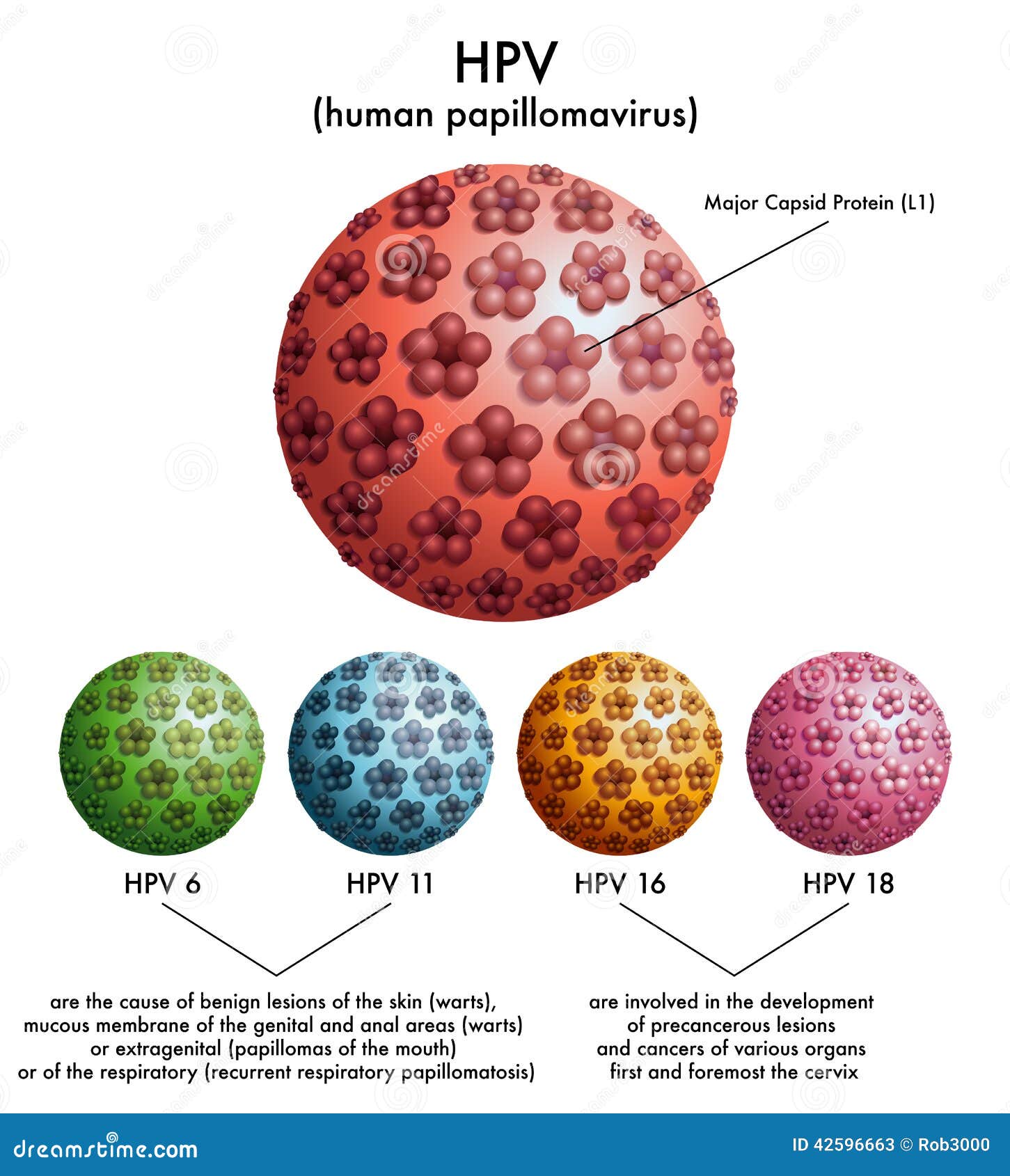 HPV (papillomavirus umano) illustrazione vettoriale. Illustrazione di